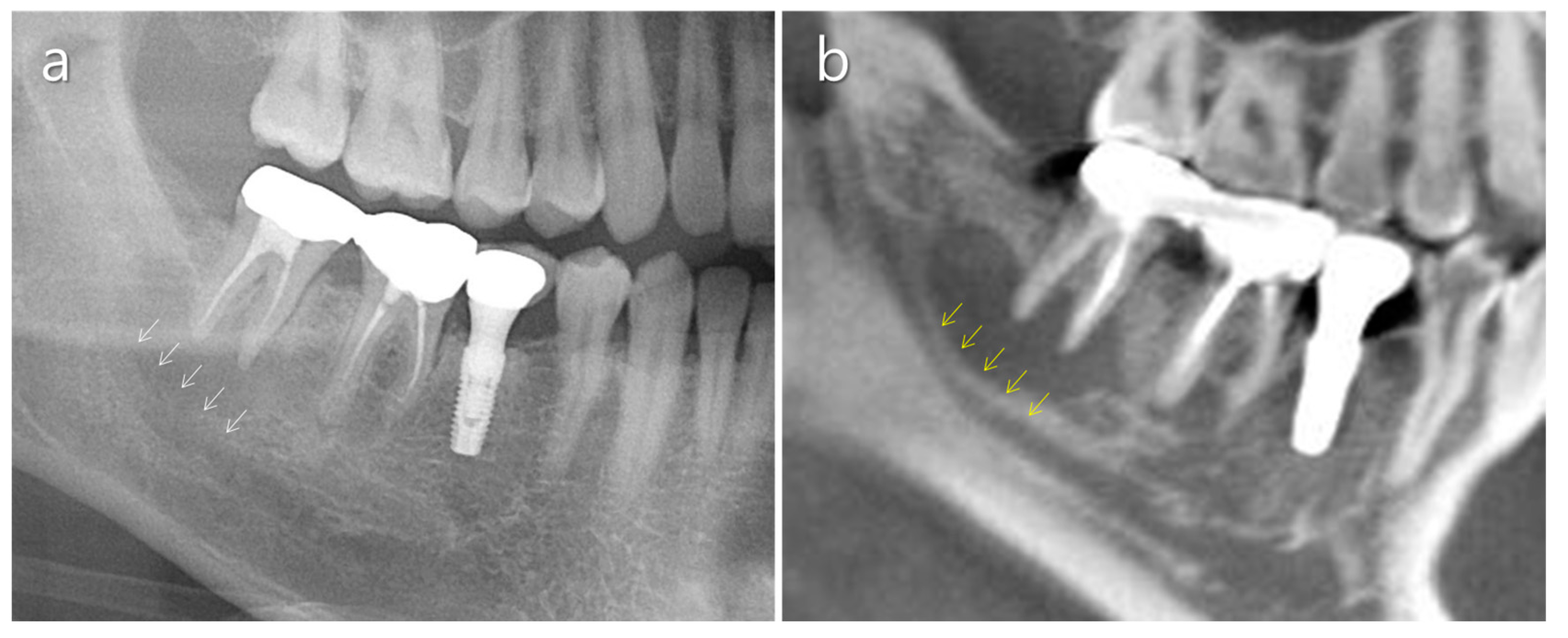 Medicina 57 00270 g005 Medicina 57 00270 g005