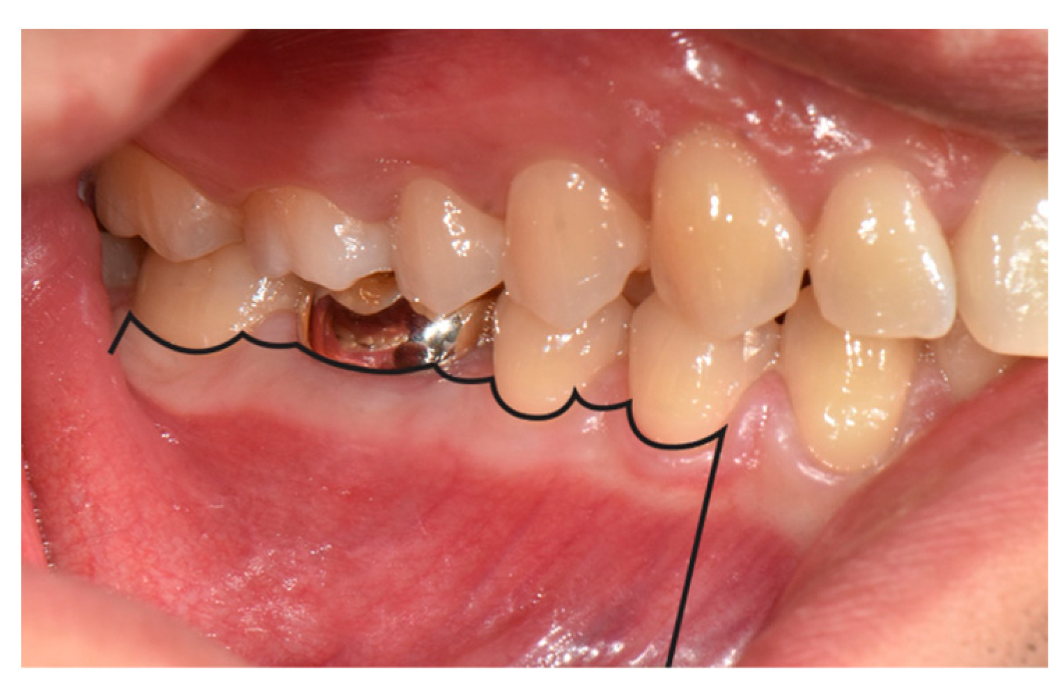 Medicina 57 00270 g009 Medicina 57 00270 g009