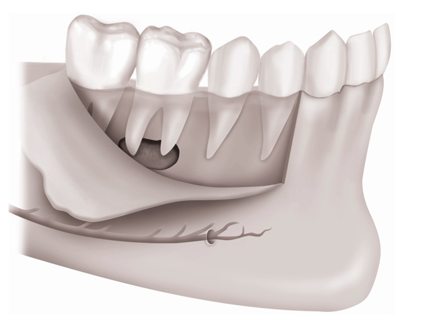 Medicina 57 00270 g010 Medicina 57 00270 g010