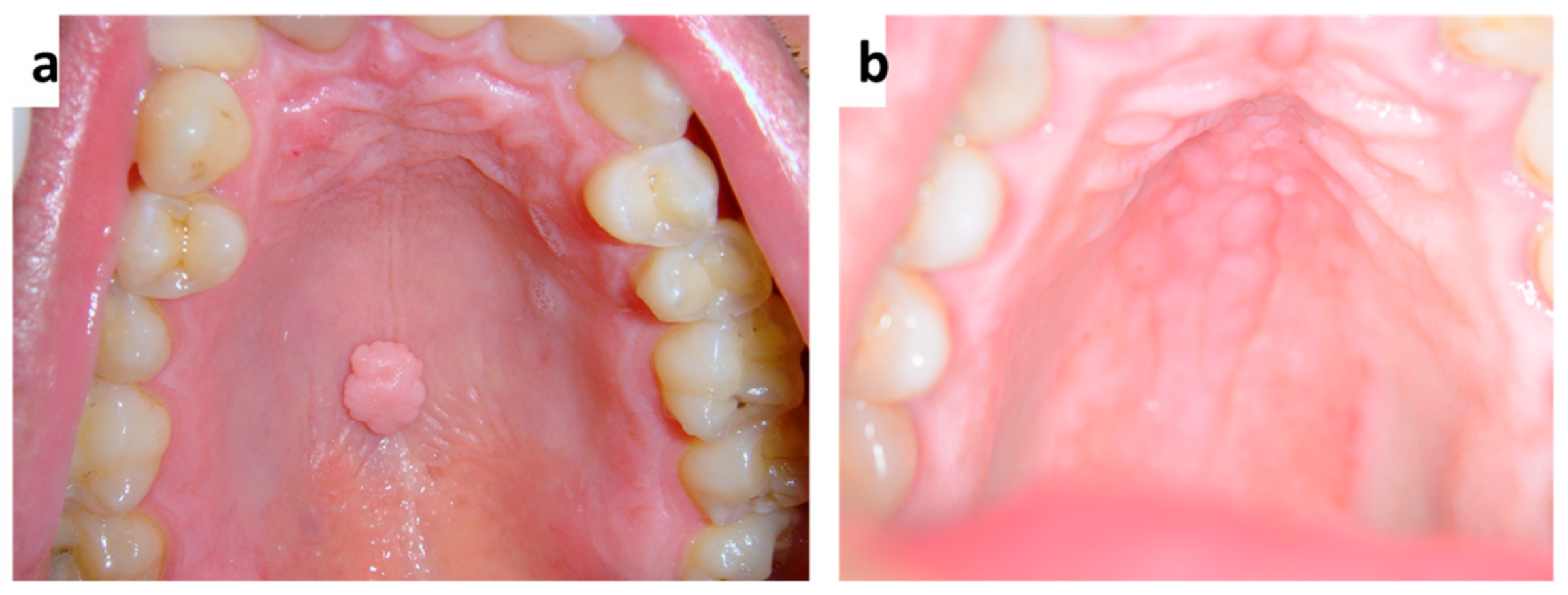 Medicina 57 00271 g003