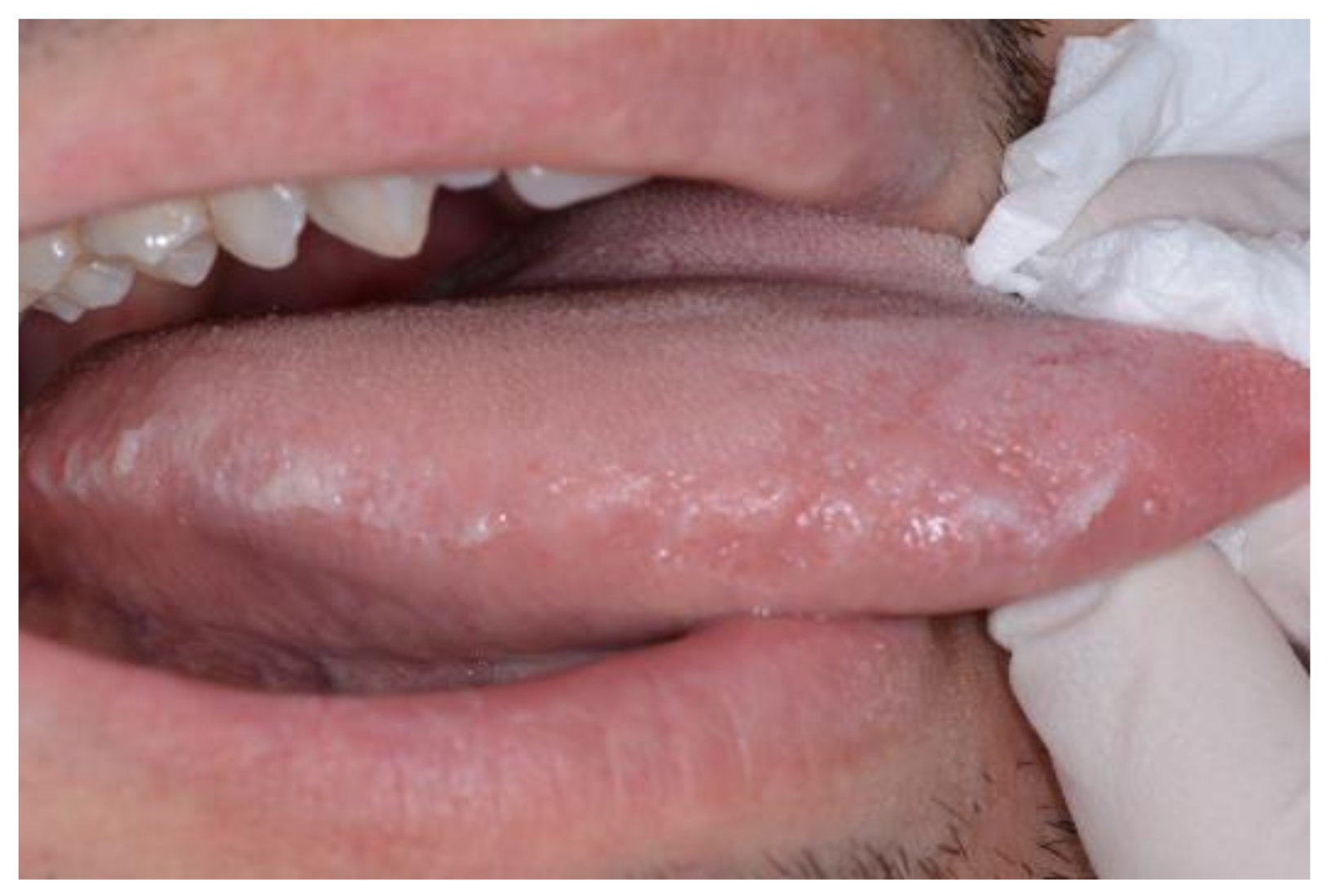 Medicina 57 00271 g004