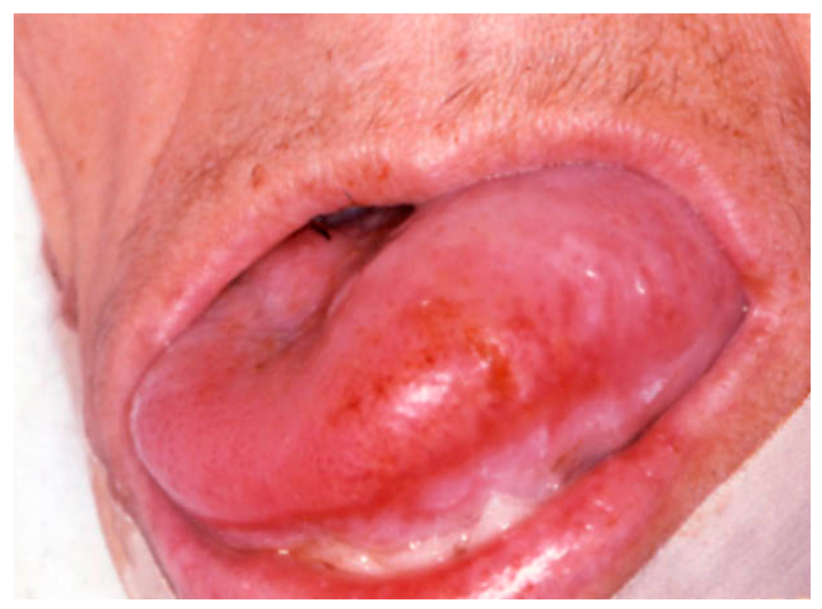 Medicina 57 00271 g005