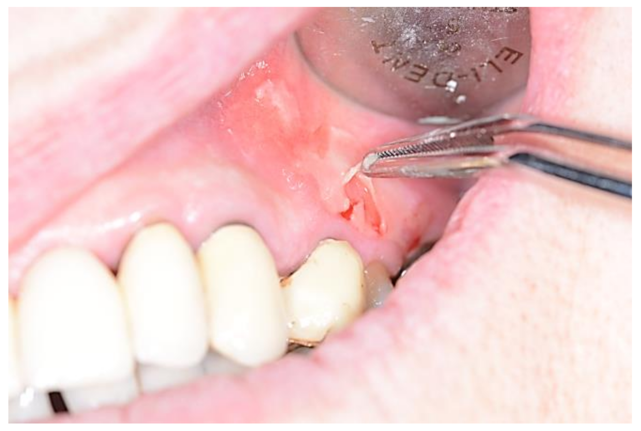 Medicina 57 00271 g006