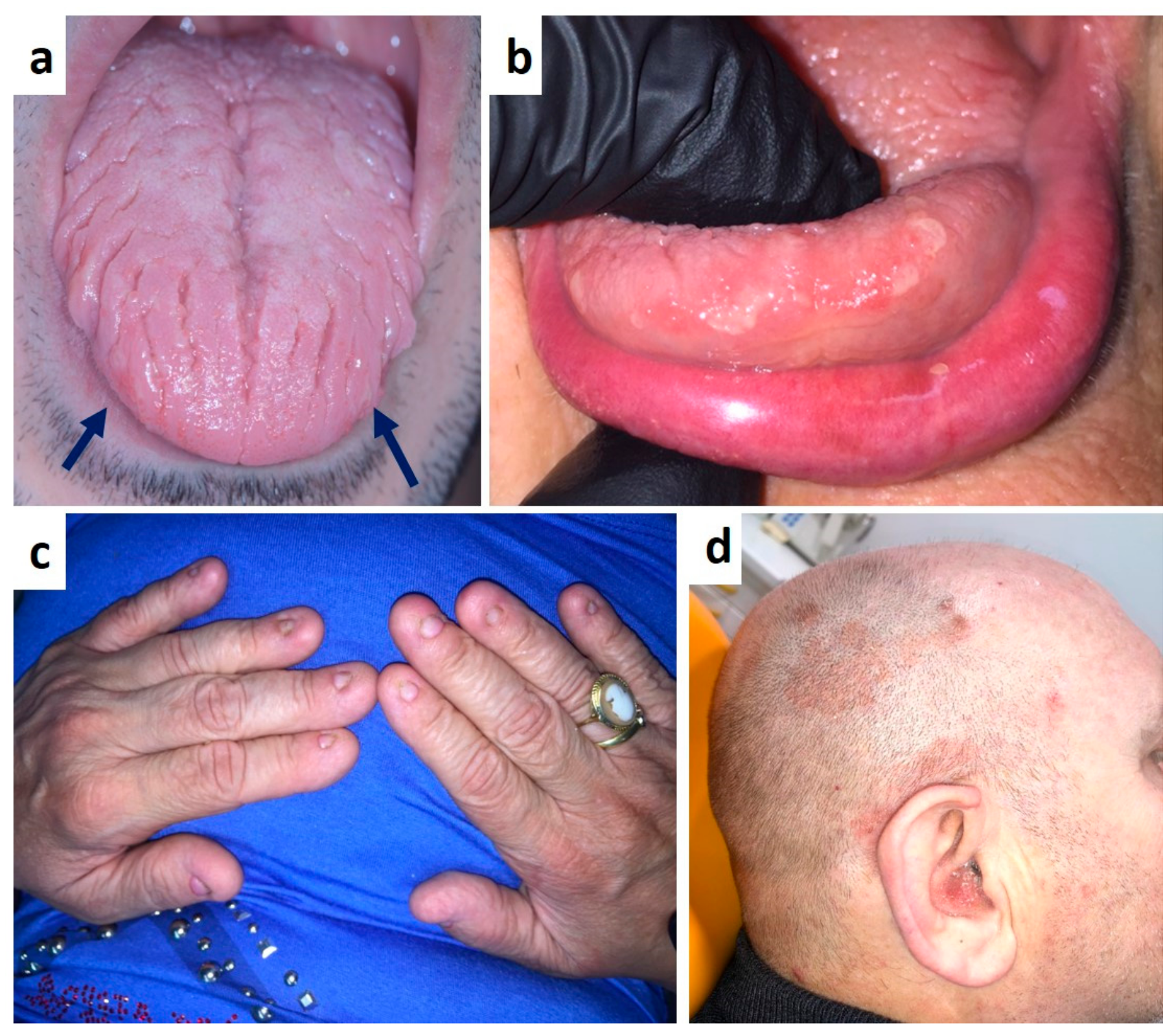 Medicina 57 00271 g008