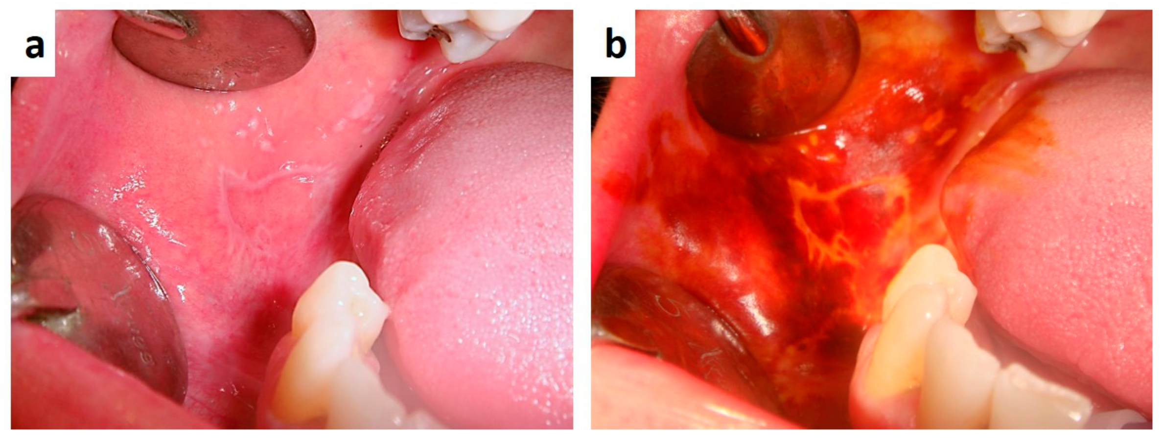 Medicina 57 00271 g010