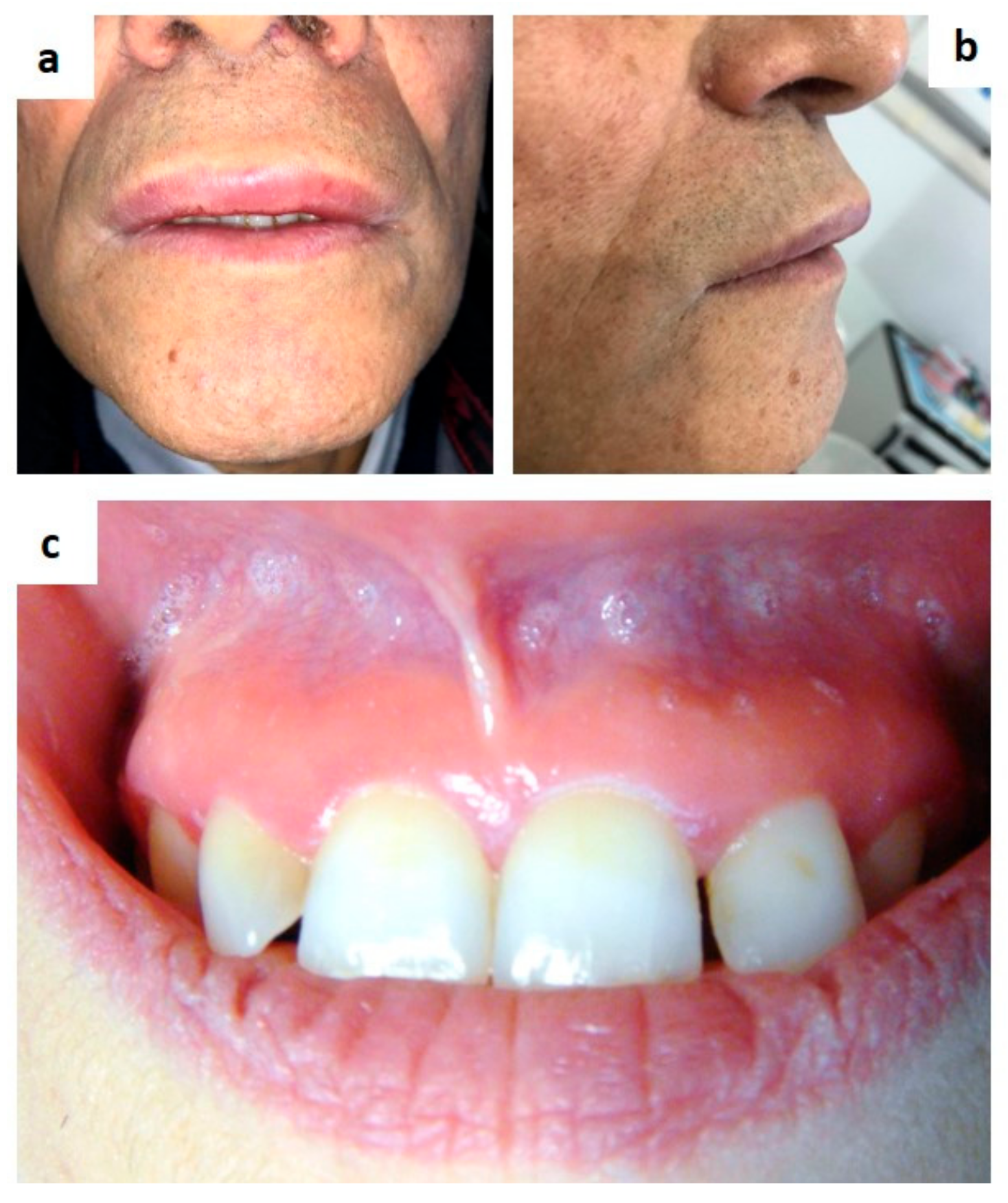 Medicina 57 00271 g012