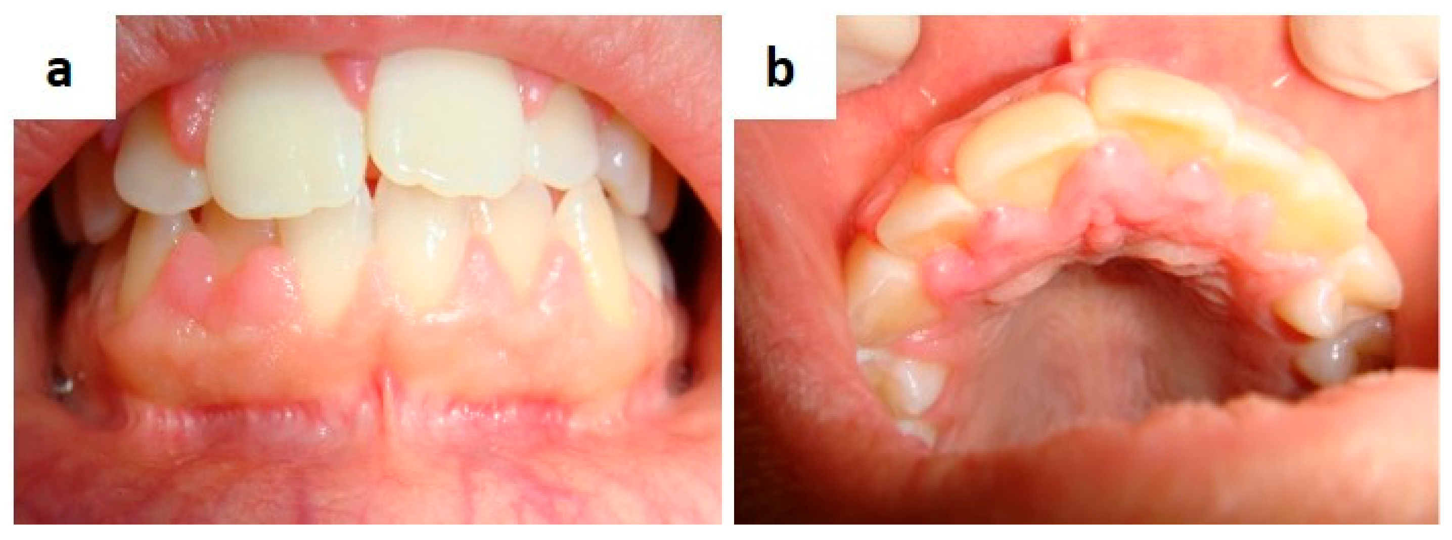 Medicina 57 00271 g014