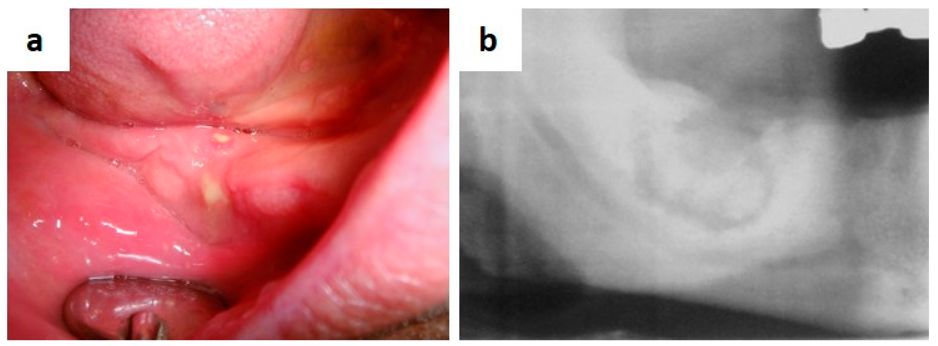 Medicina 57 00271 g015