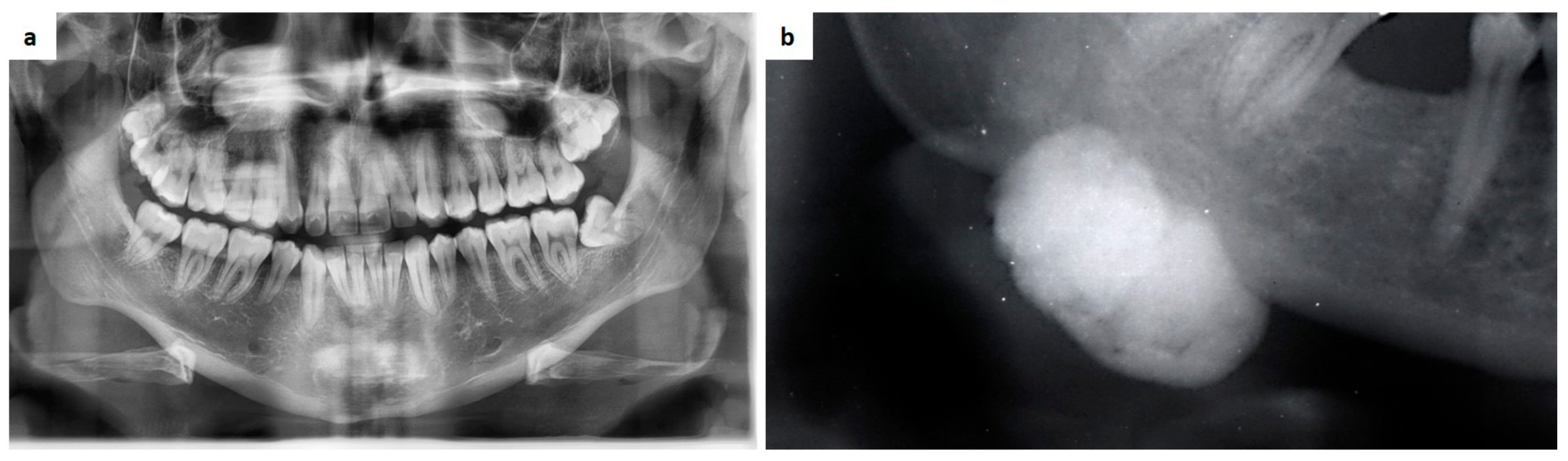Medicina 57 00271 g017