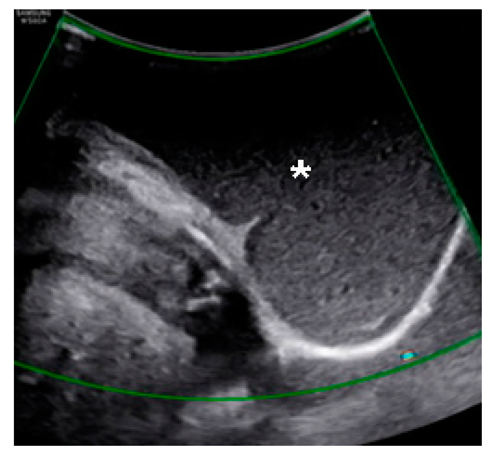 Medicina 57 00276 g002