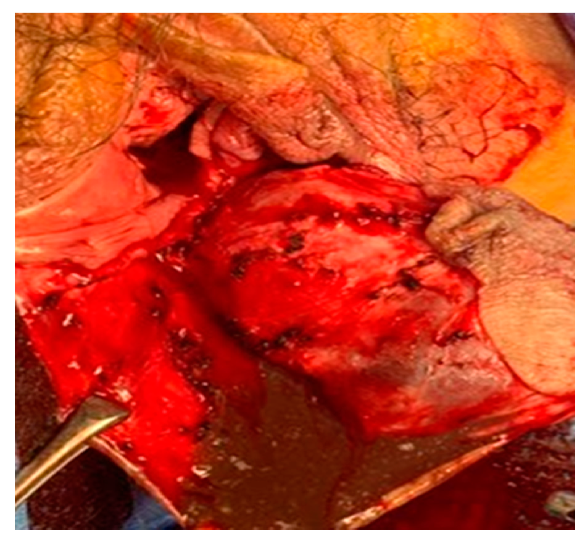 Medicina 57 00276 g004