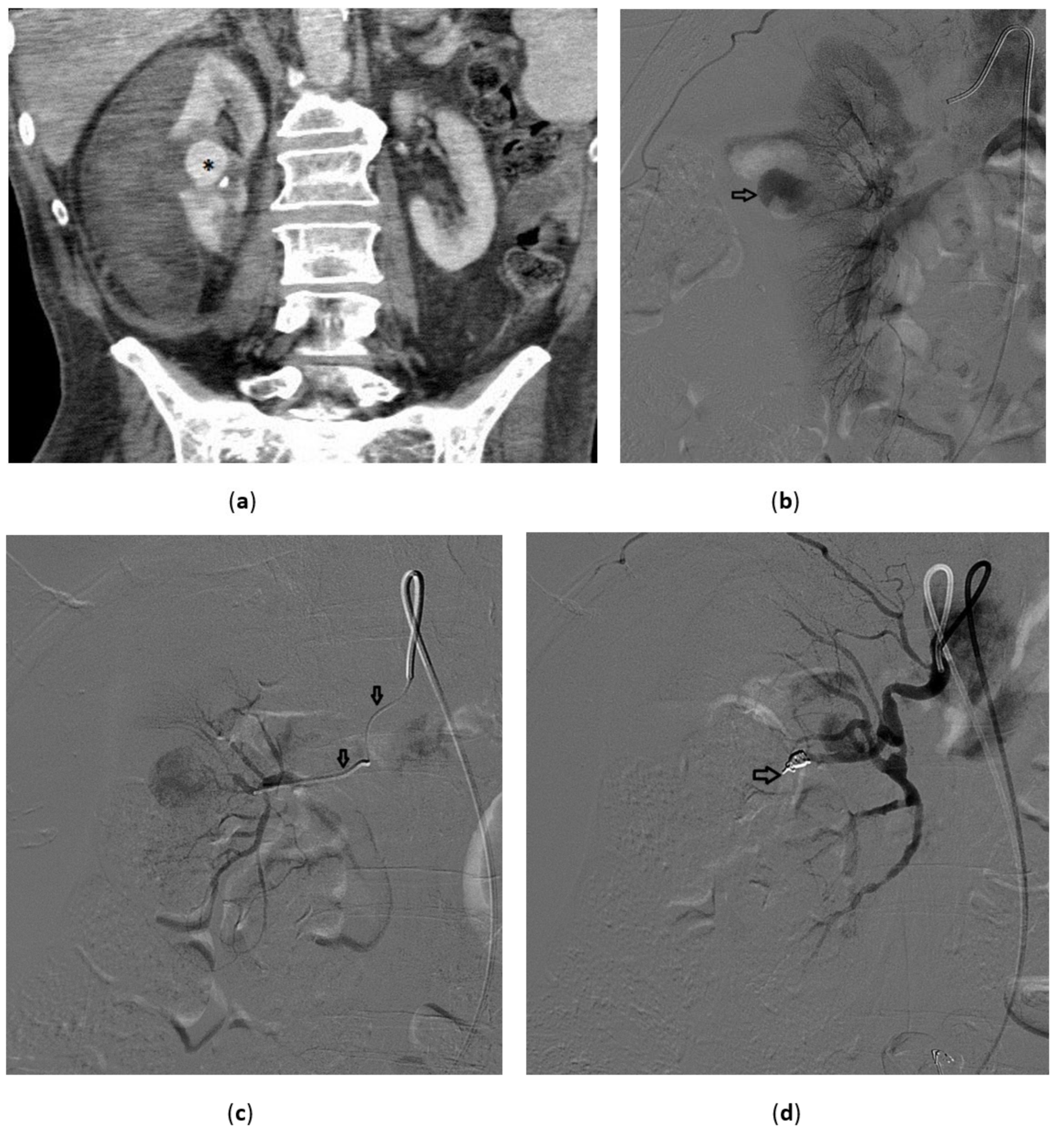 Medicina 57 00278 g002