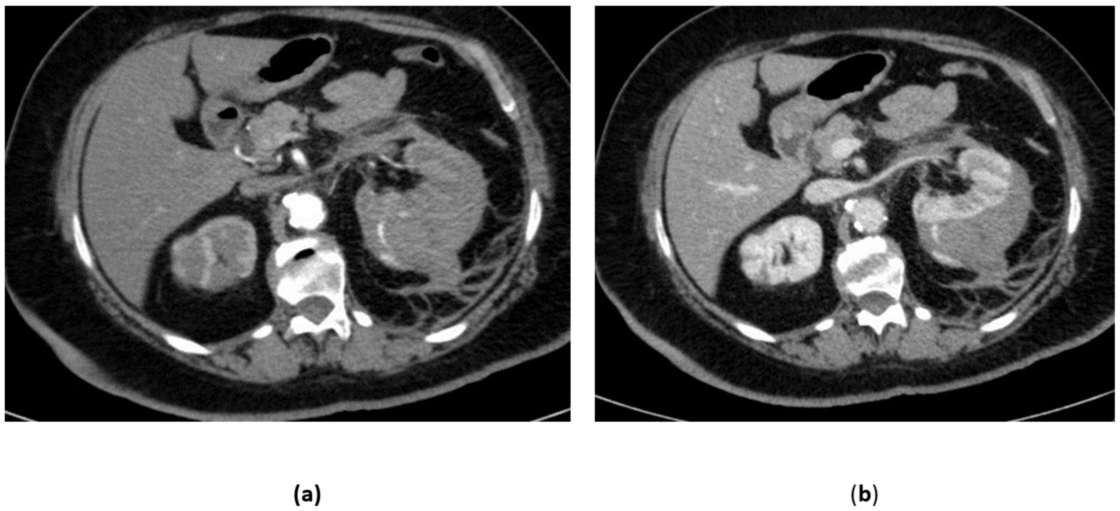 Medicina 57 00278 g004a