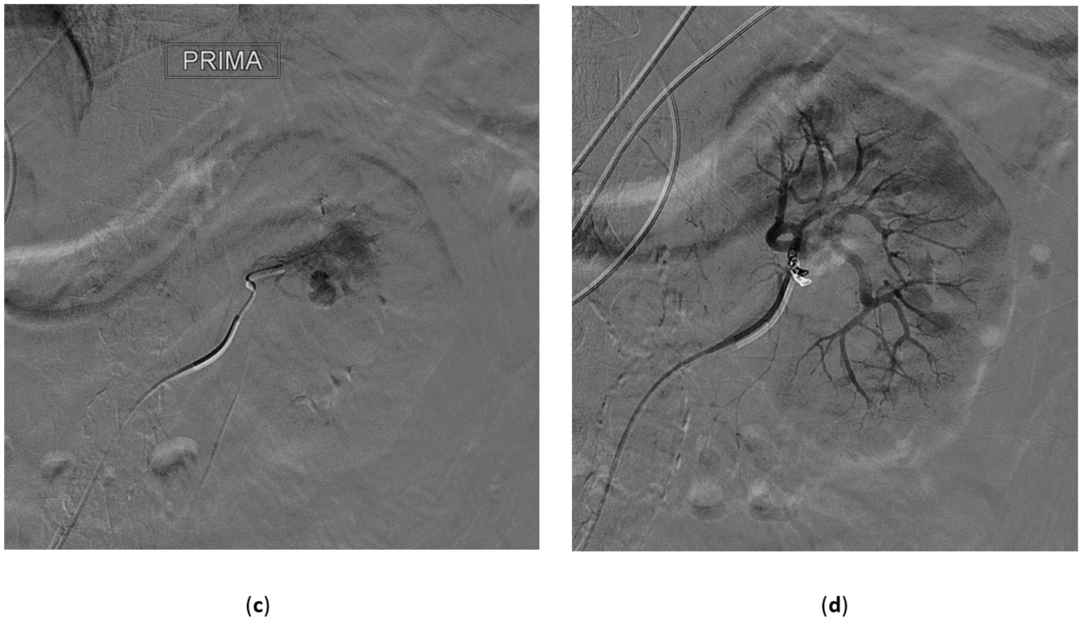 Medicina 57 00278 g004b