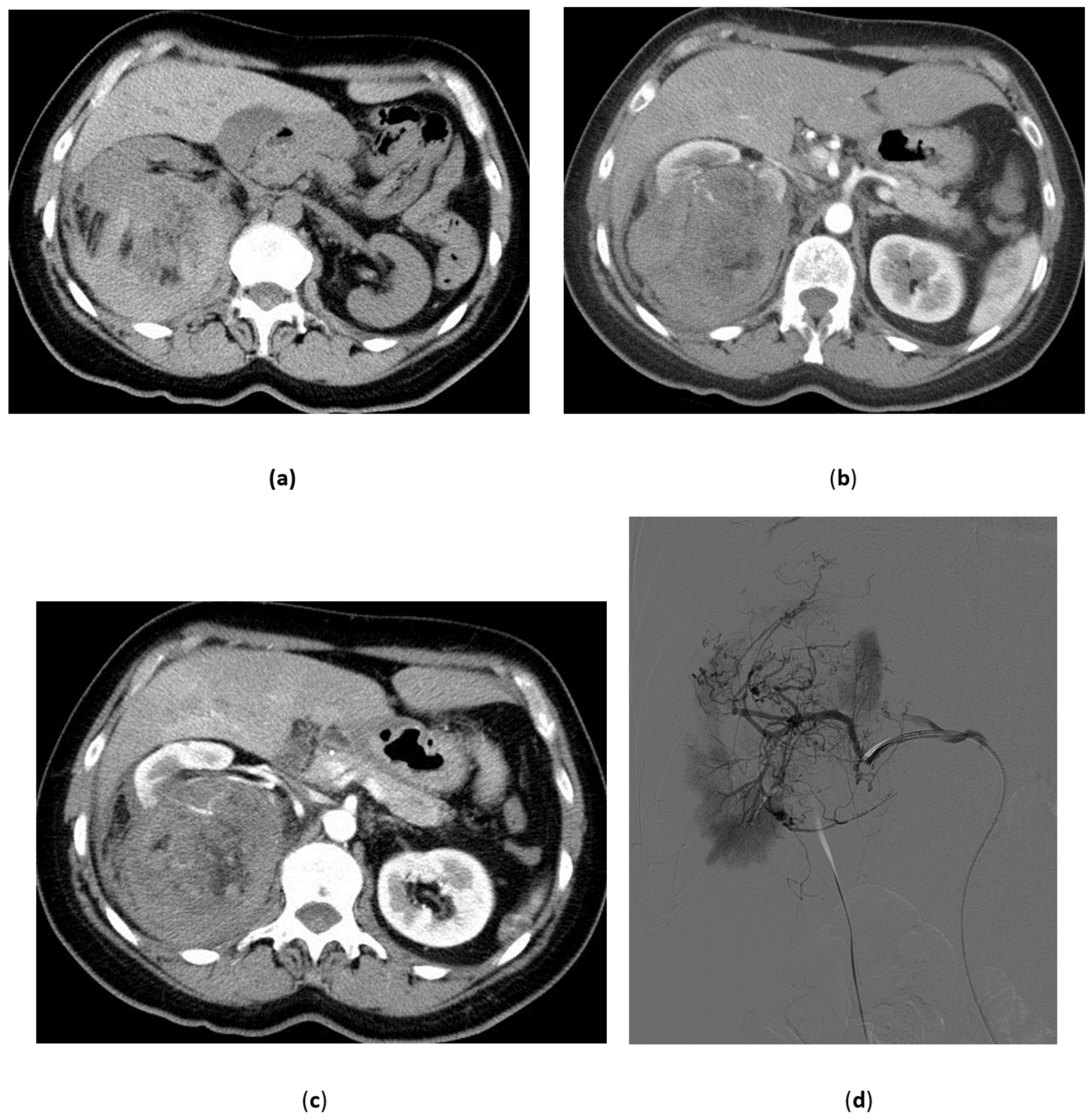Medicina 57 00278 g005a