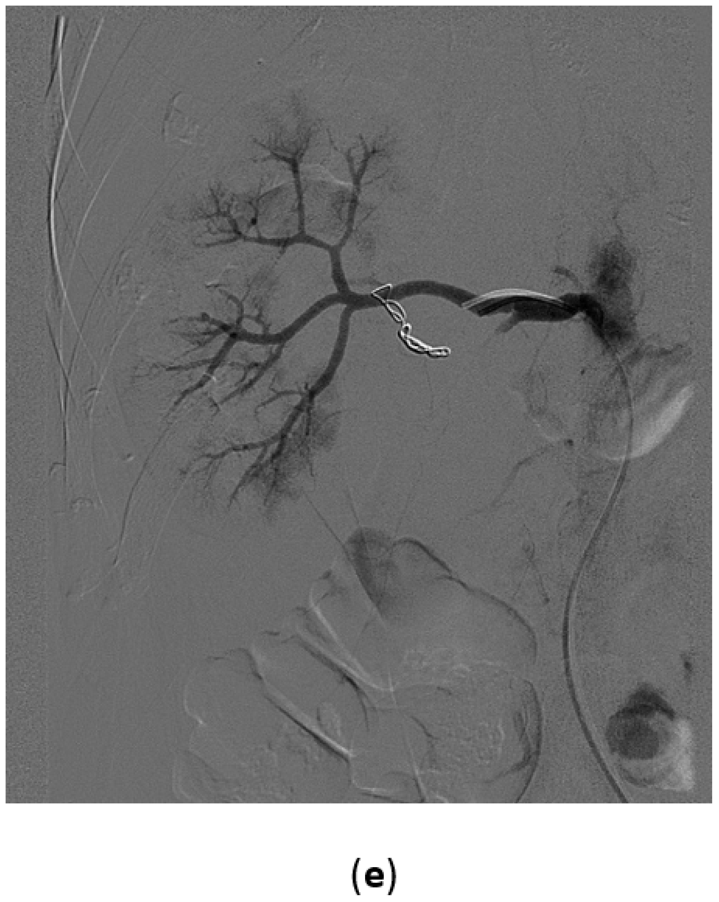 Medicina 57 00278 g005b