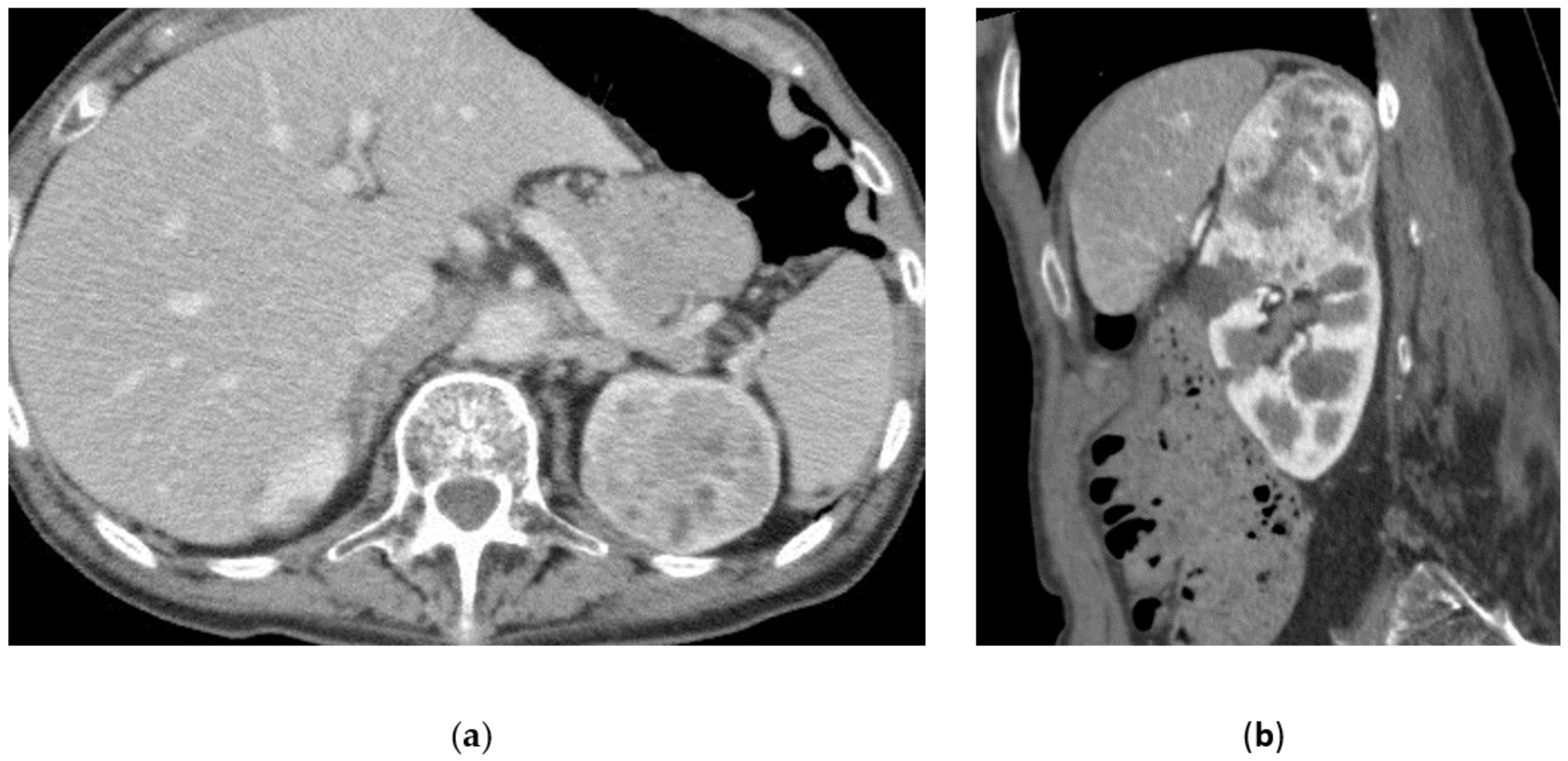 Medicina 57 00278 g006a