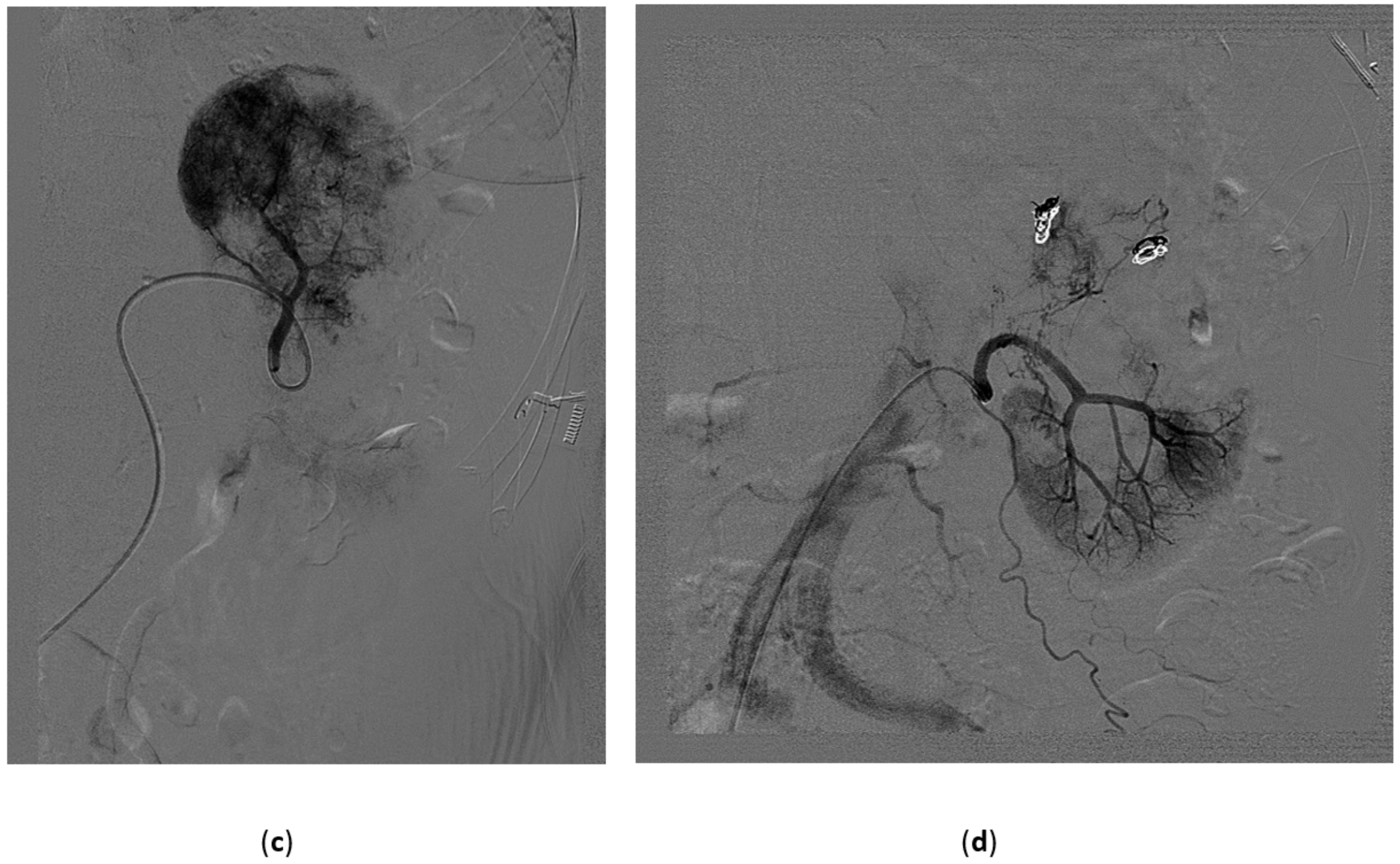 Medicina 57 00278 g006b