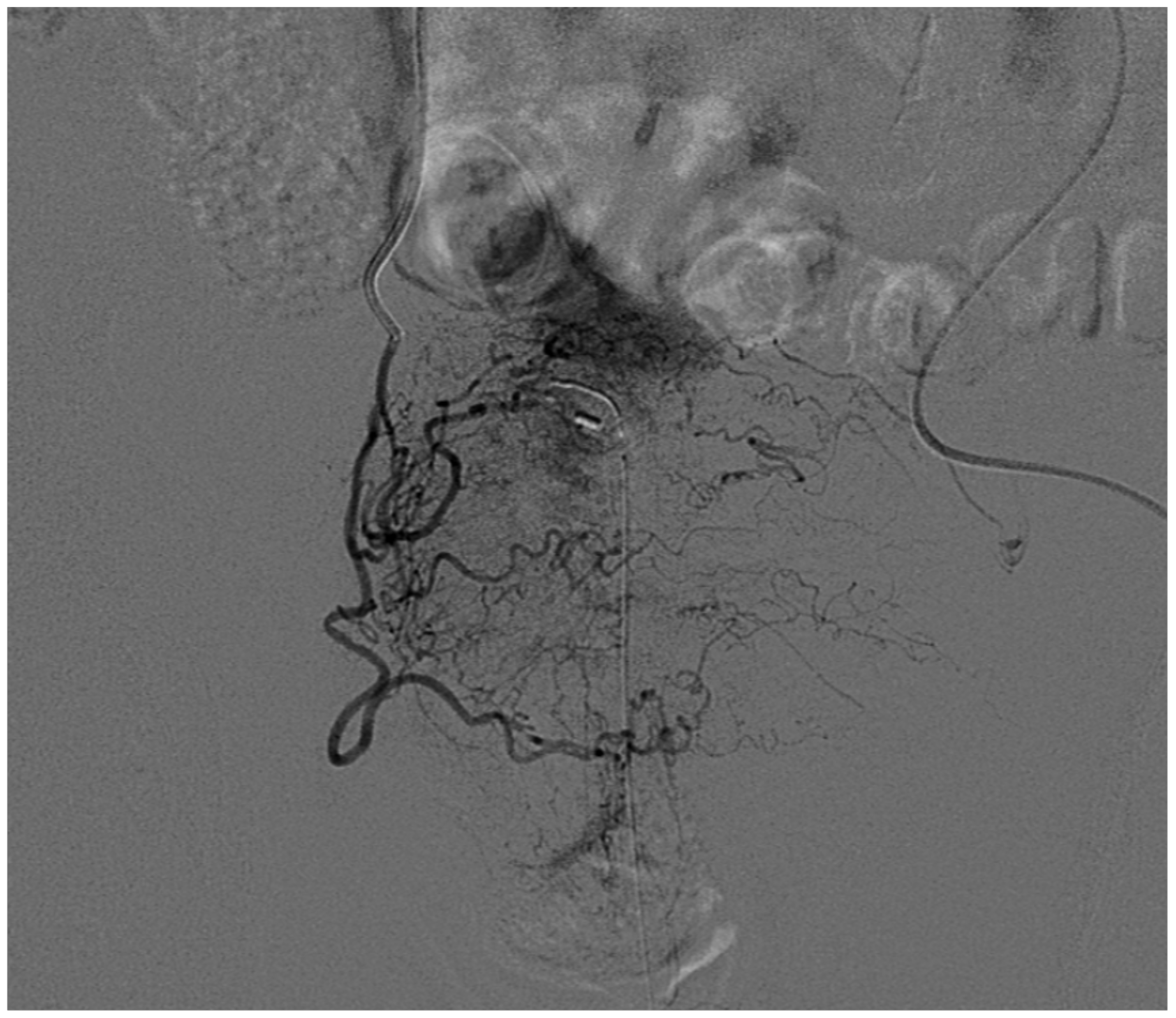 Medicina 57 00278 g007