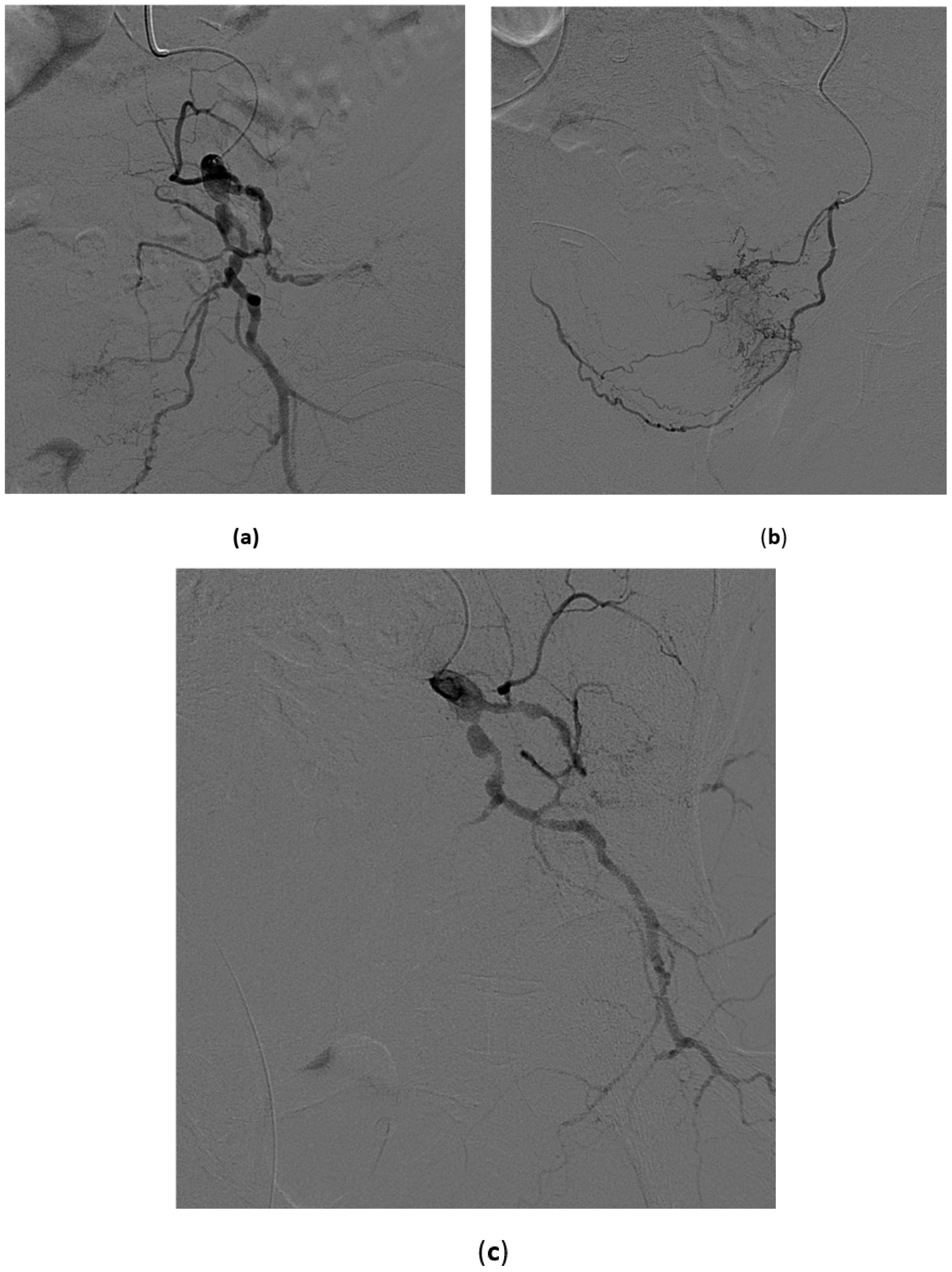 Medicina 57 00278 g008
