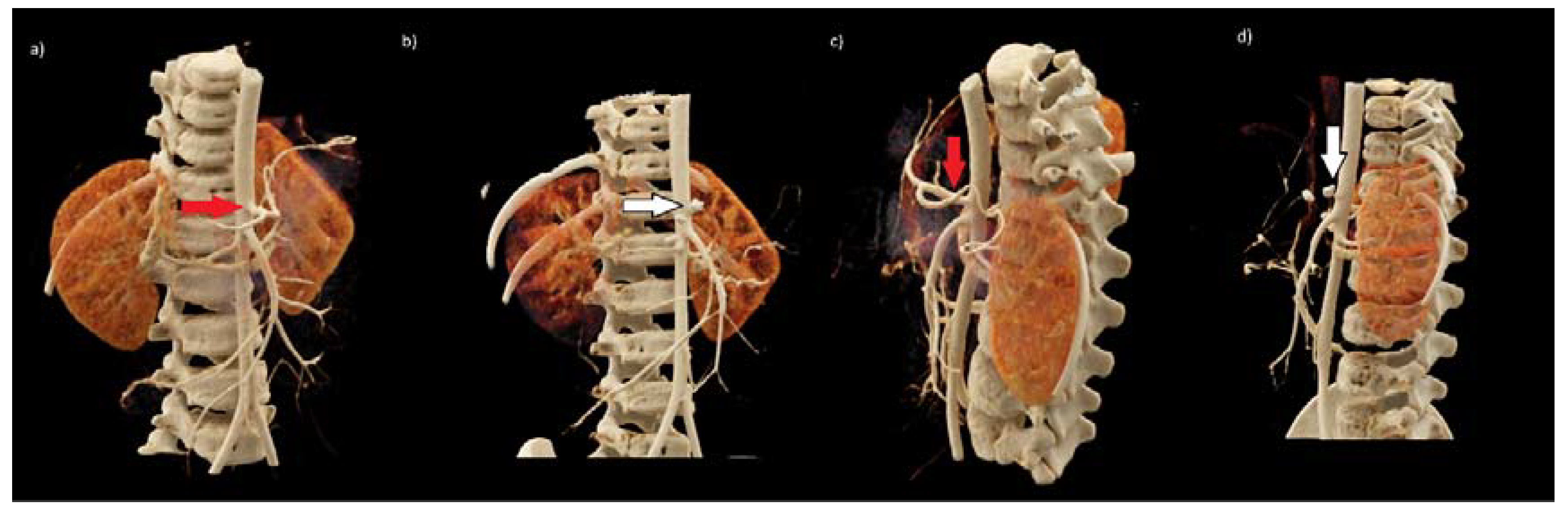 Medicina 57 00279 g003