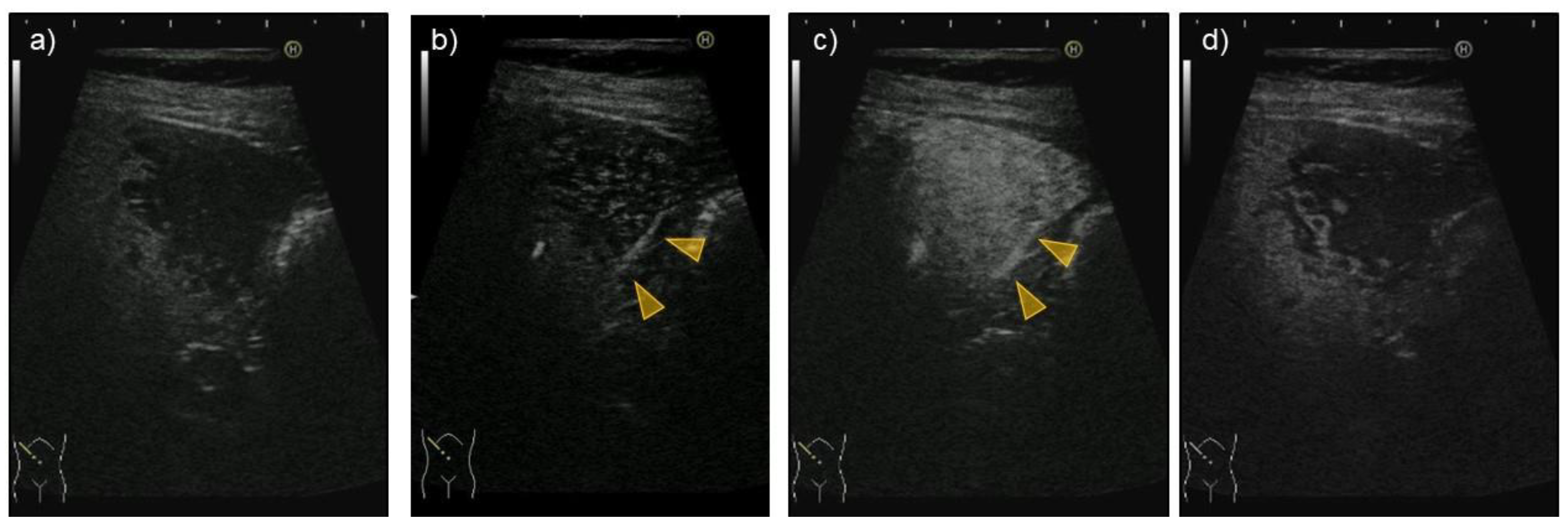 Medicina 57 00280 g002