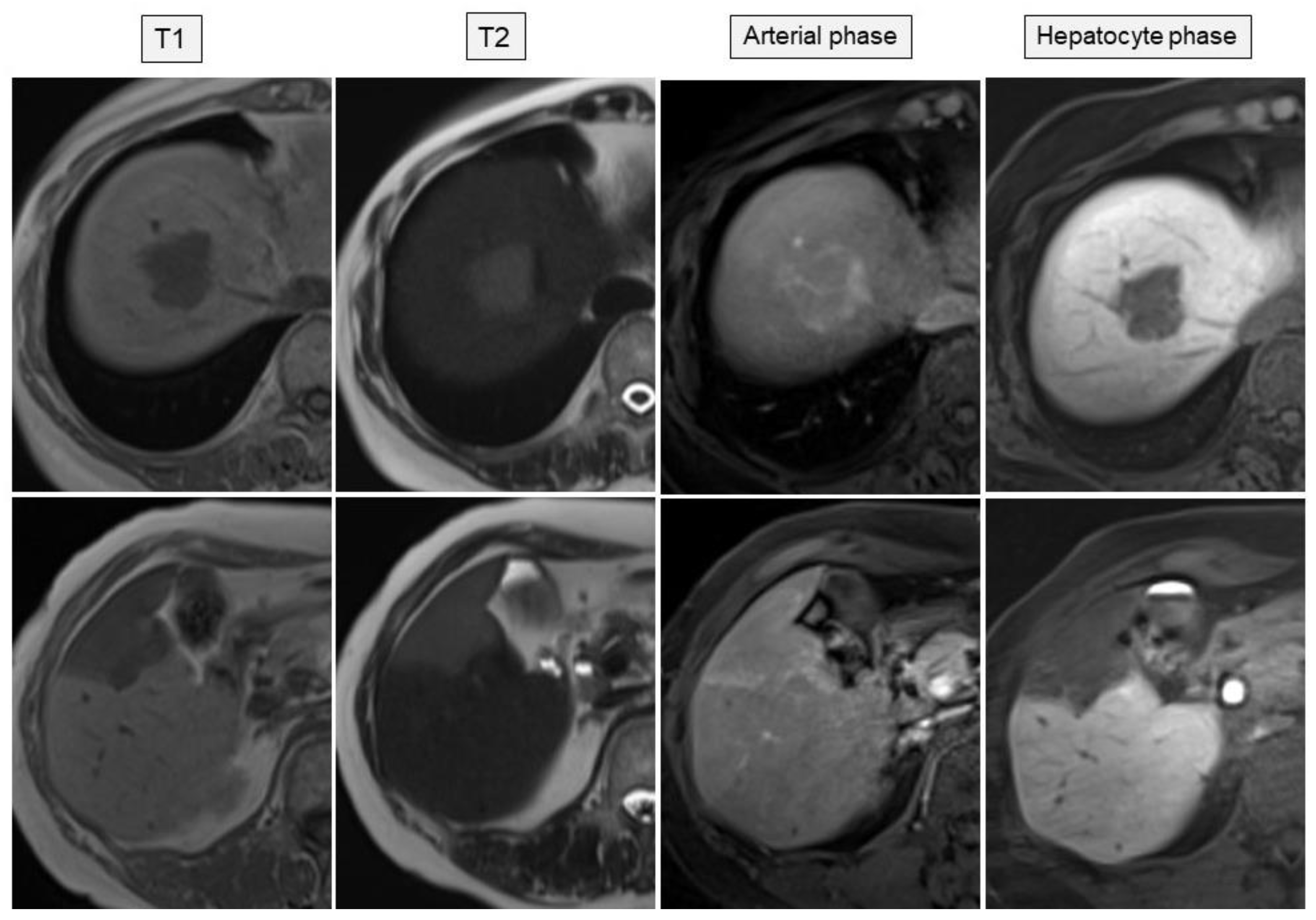 Medicina 57 00280 g004