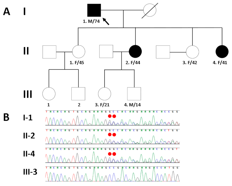 Medicina Free Full Text Phenotypic Diversity Of Cardiomyopathy Caused By An Mybpc3 Frameshift Mutation In A Korean Family A Case Report Html