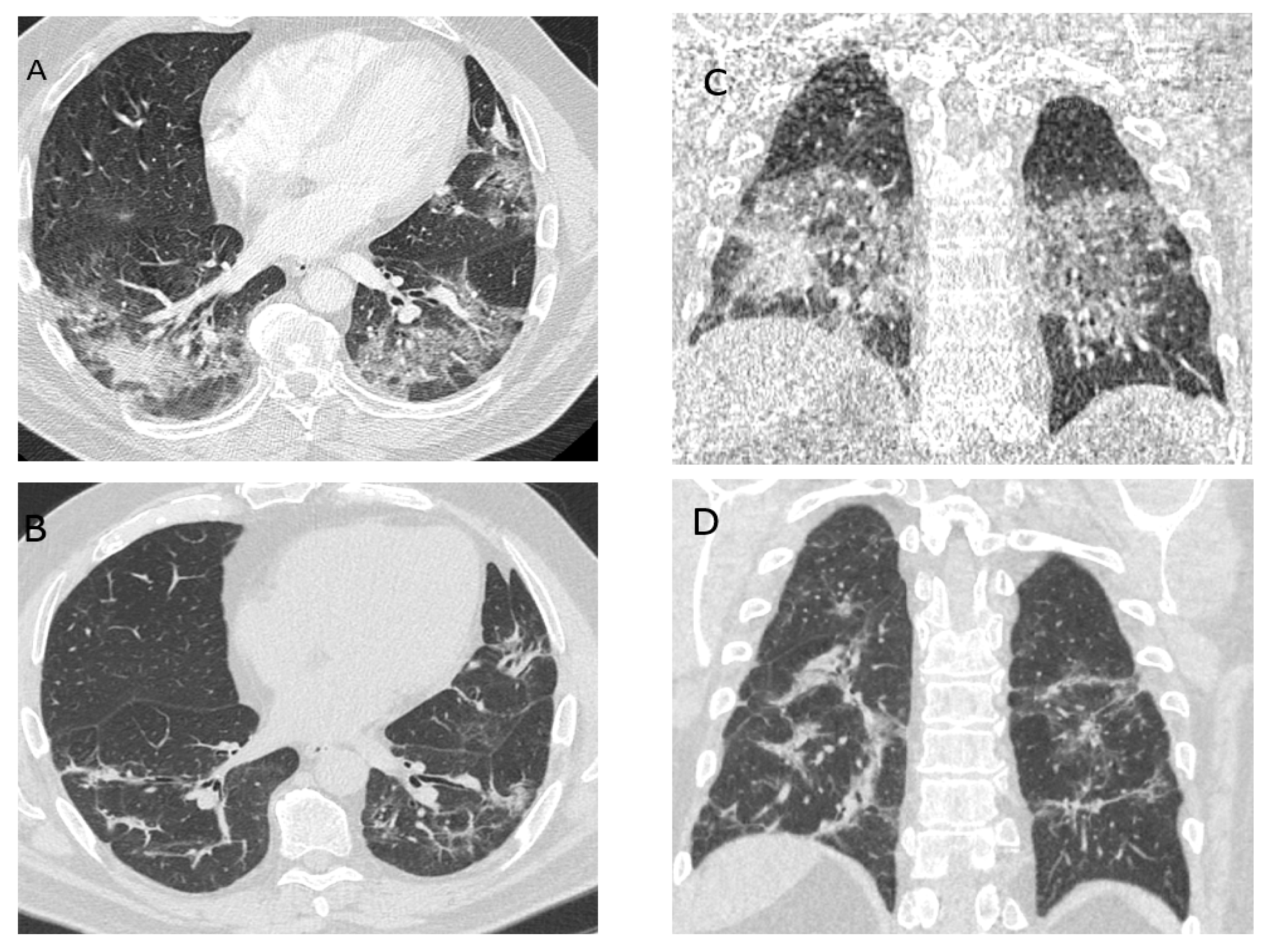 Medicina 57 00283 g002 Medicina 57 00283 g002