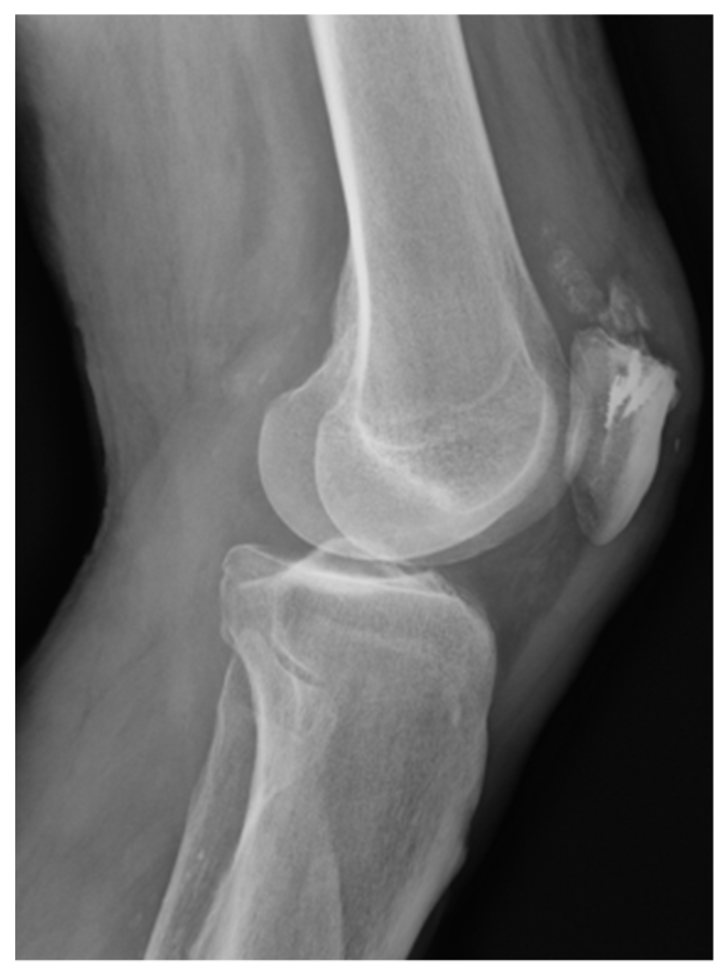 Medicina 57 00287 g001