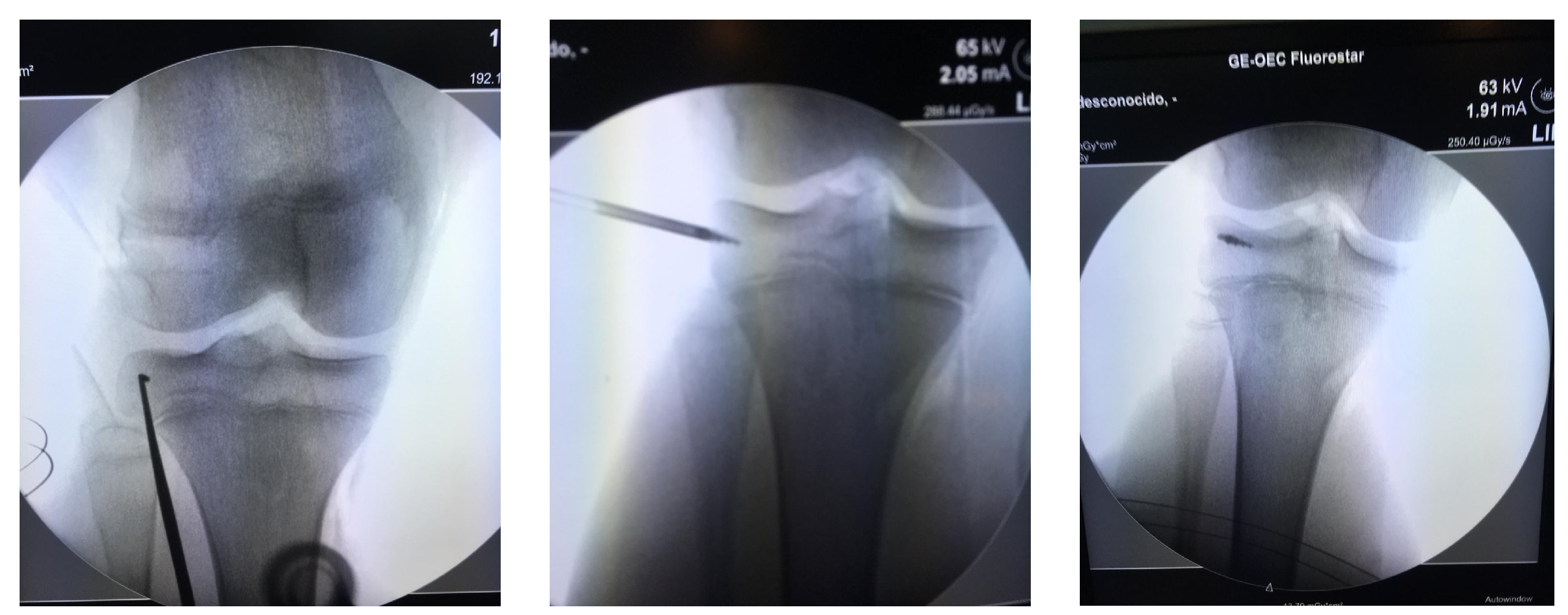 Medicina 57 00287 g005