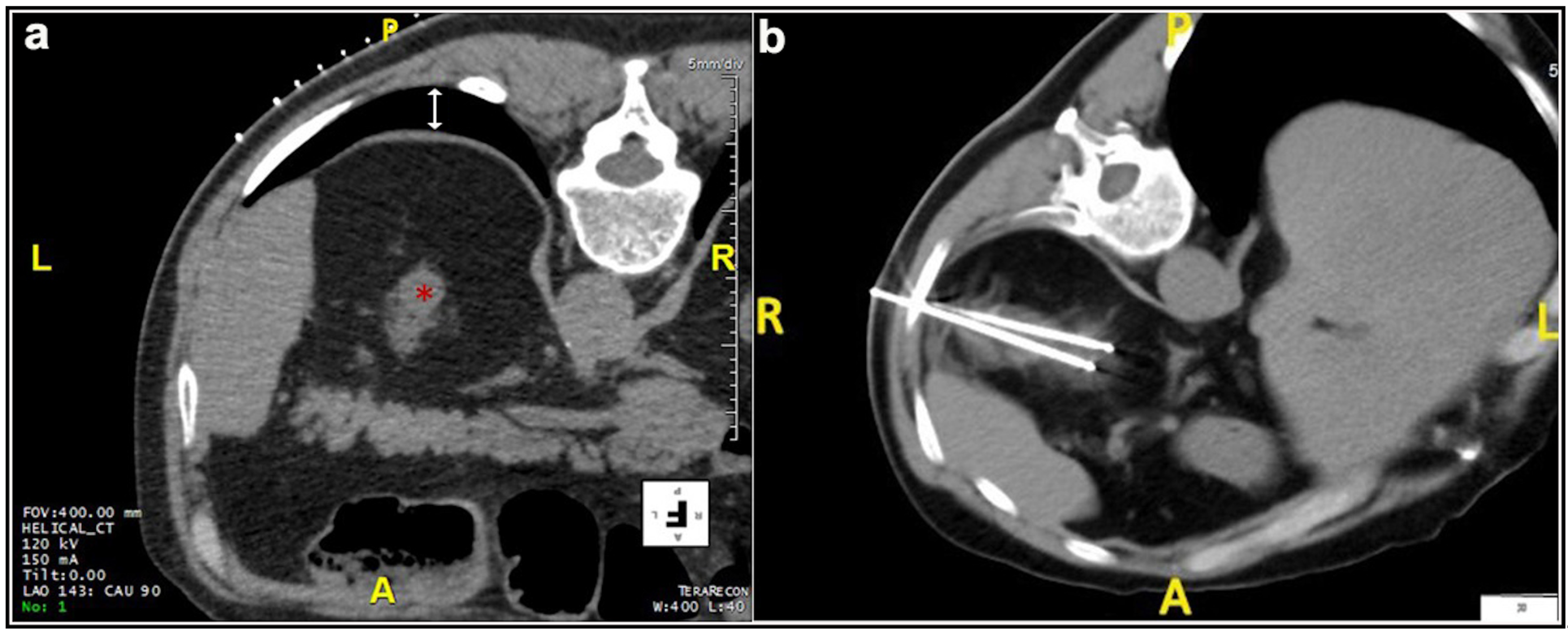 Medicina 57 00291 g001
