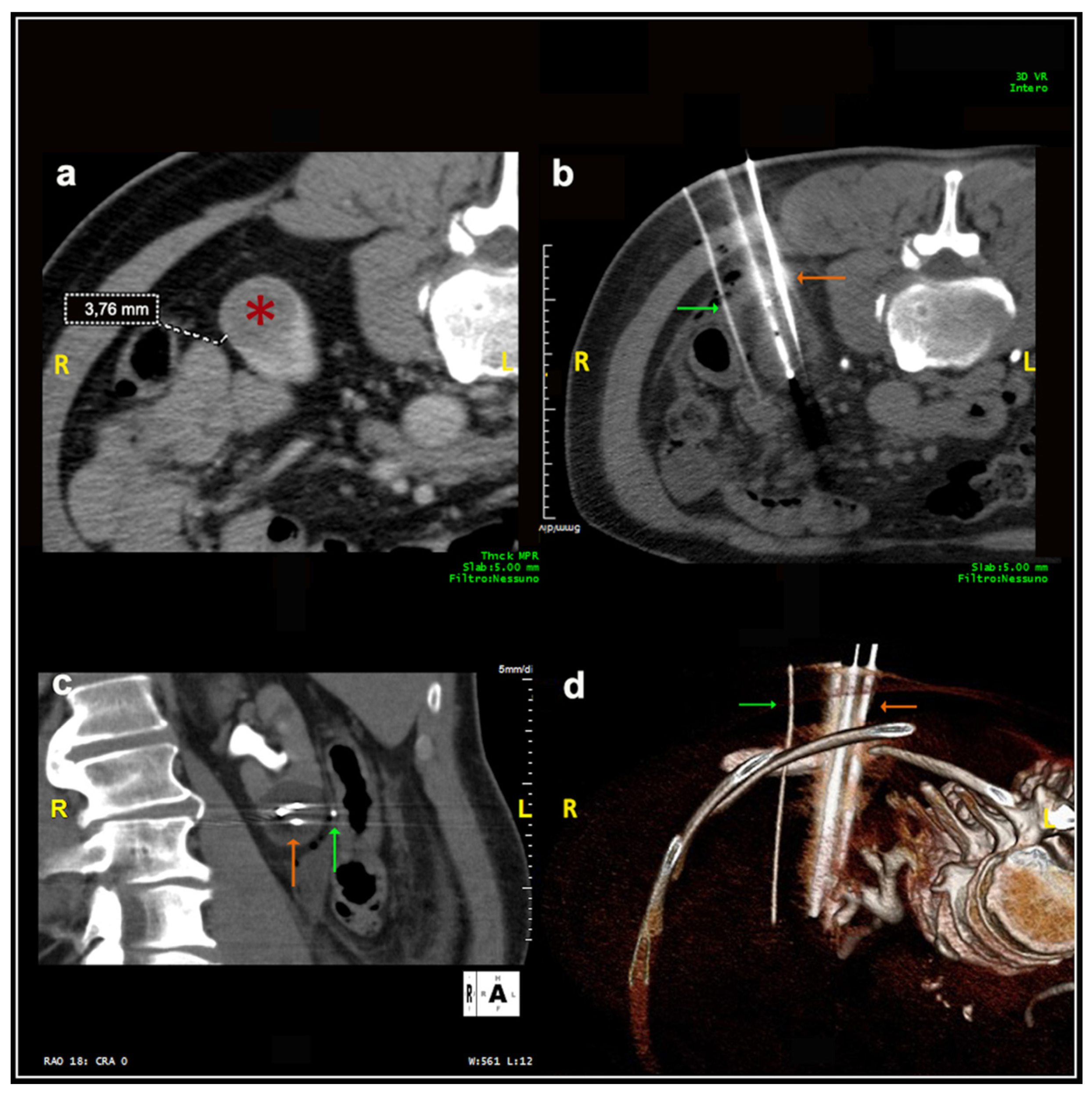Medicina 57 00291 g002