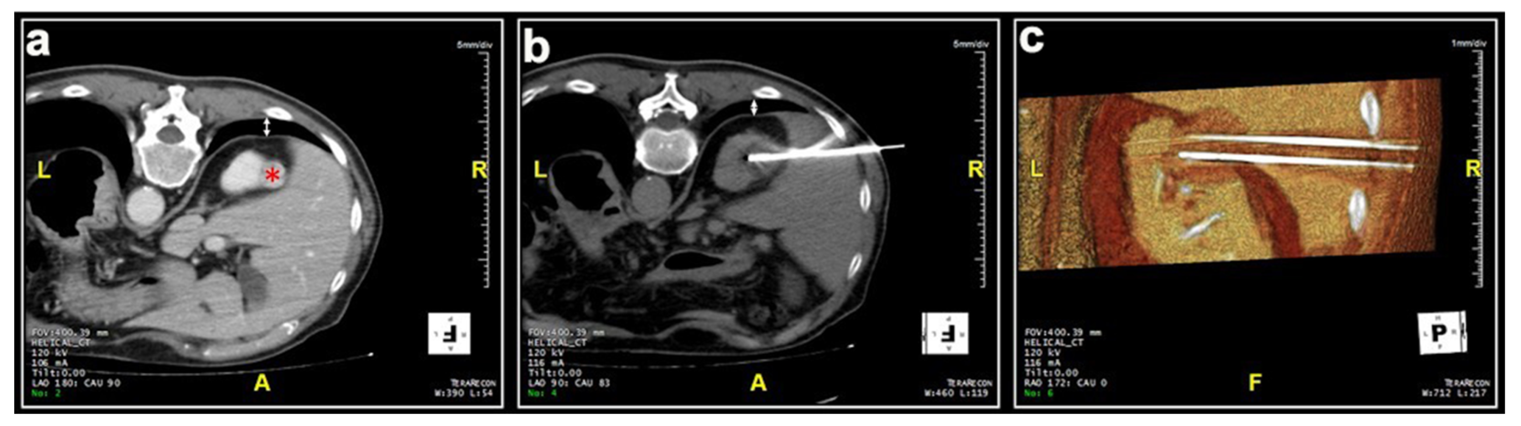 Medicina 57 00291 g003