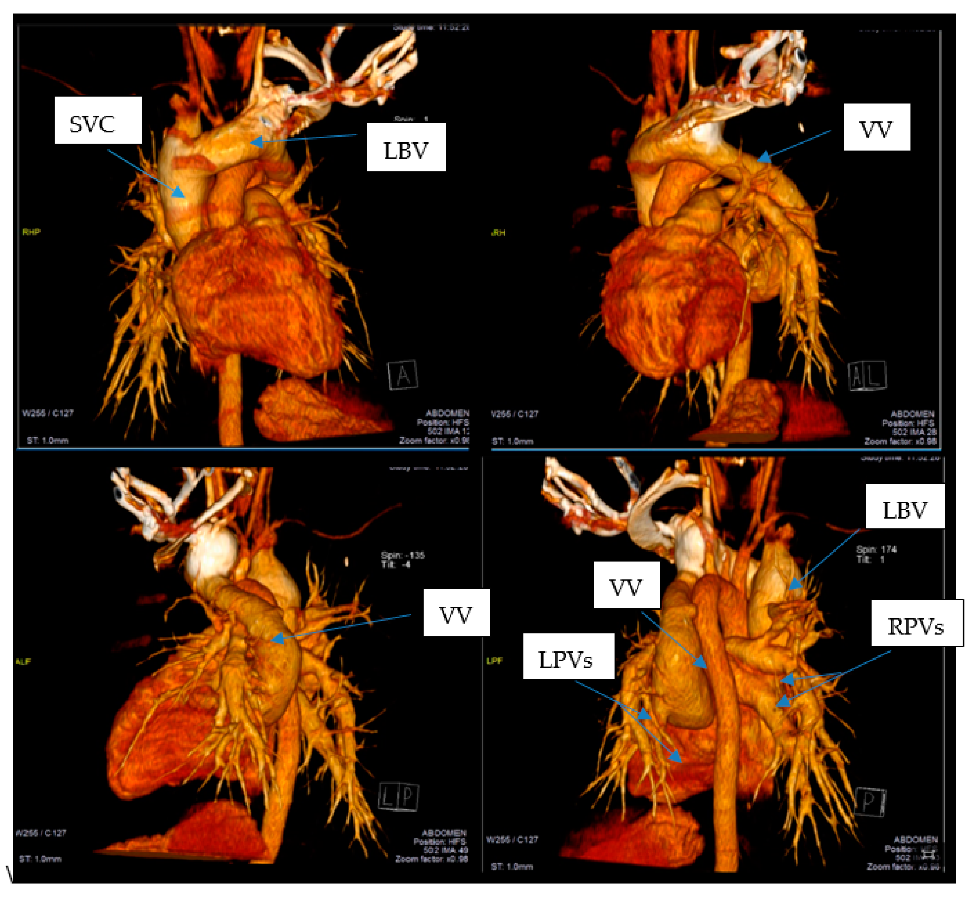 Medicina 57 00293 g002