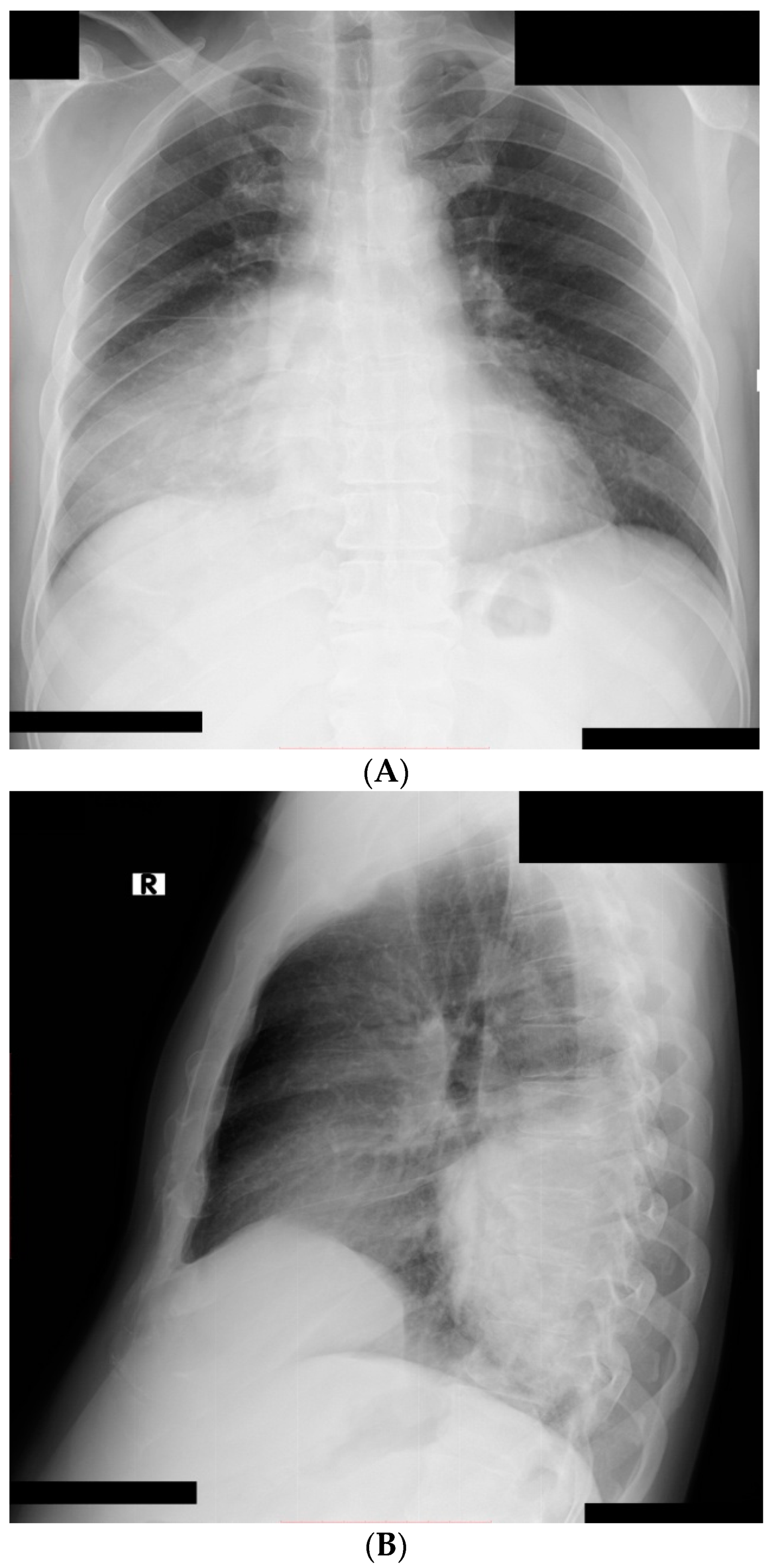 Medicina 57 00302 g001