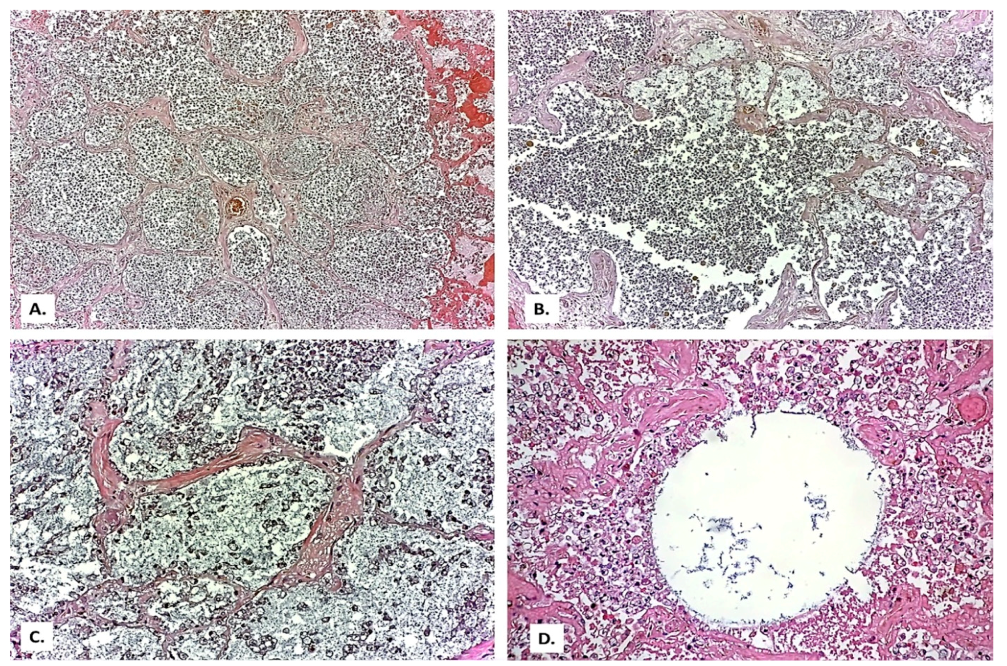 Medicina 57 00302 g002