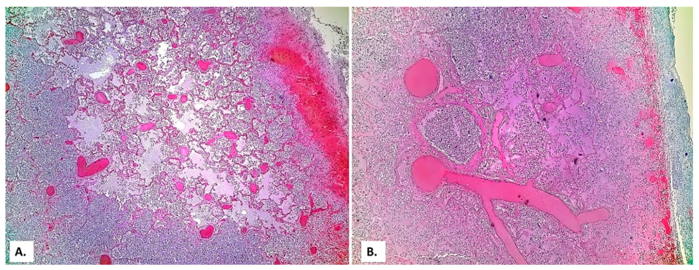 Medicina 57 00302 g003