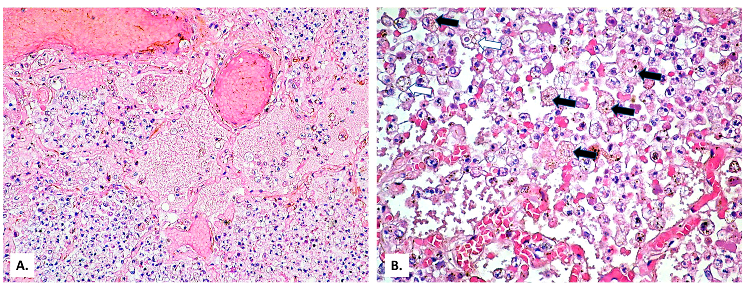 Medicina 57 00302 g006