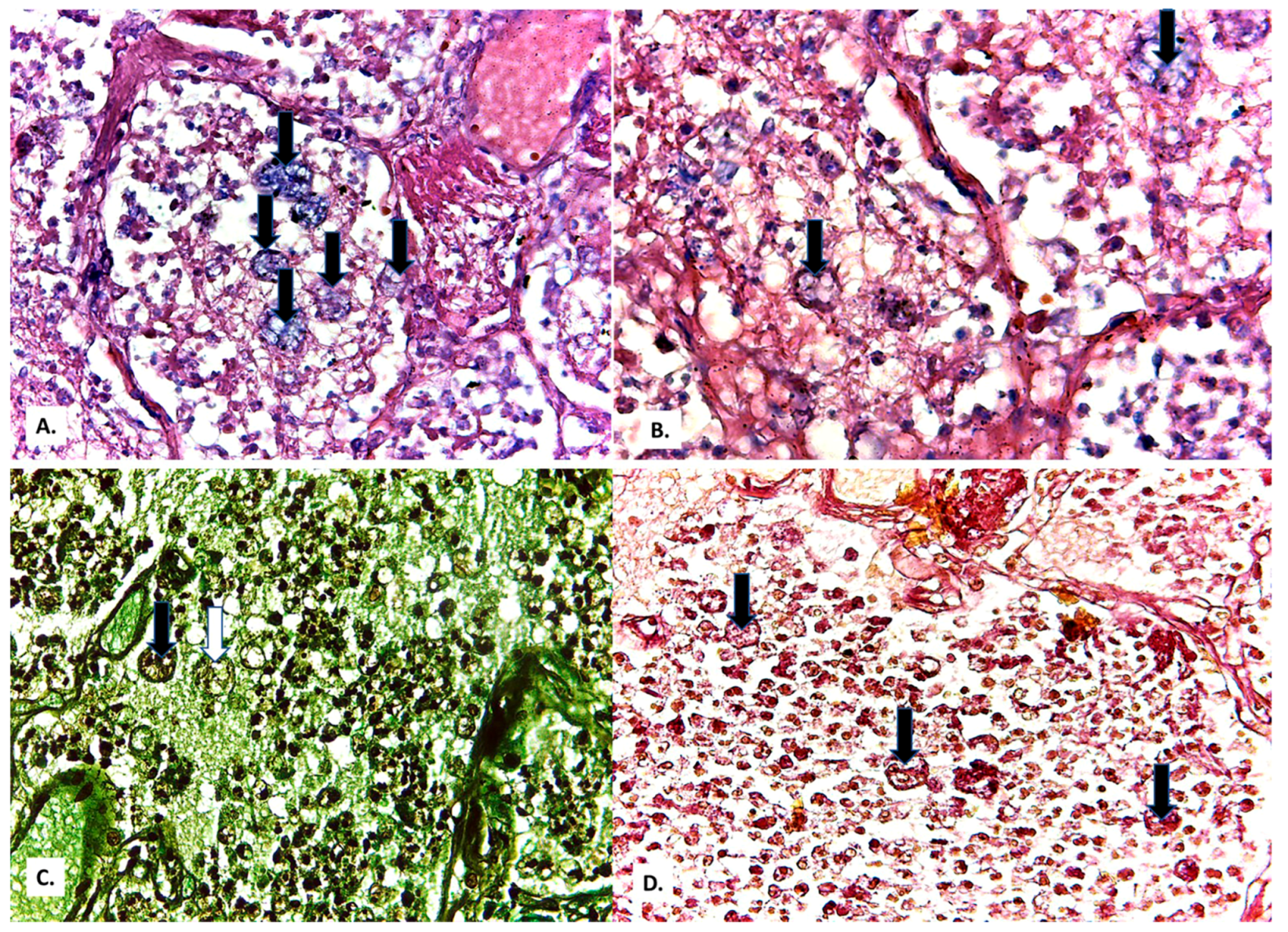 Medicina 57 00302 g010