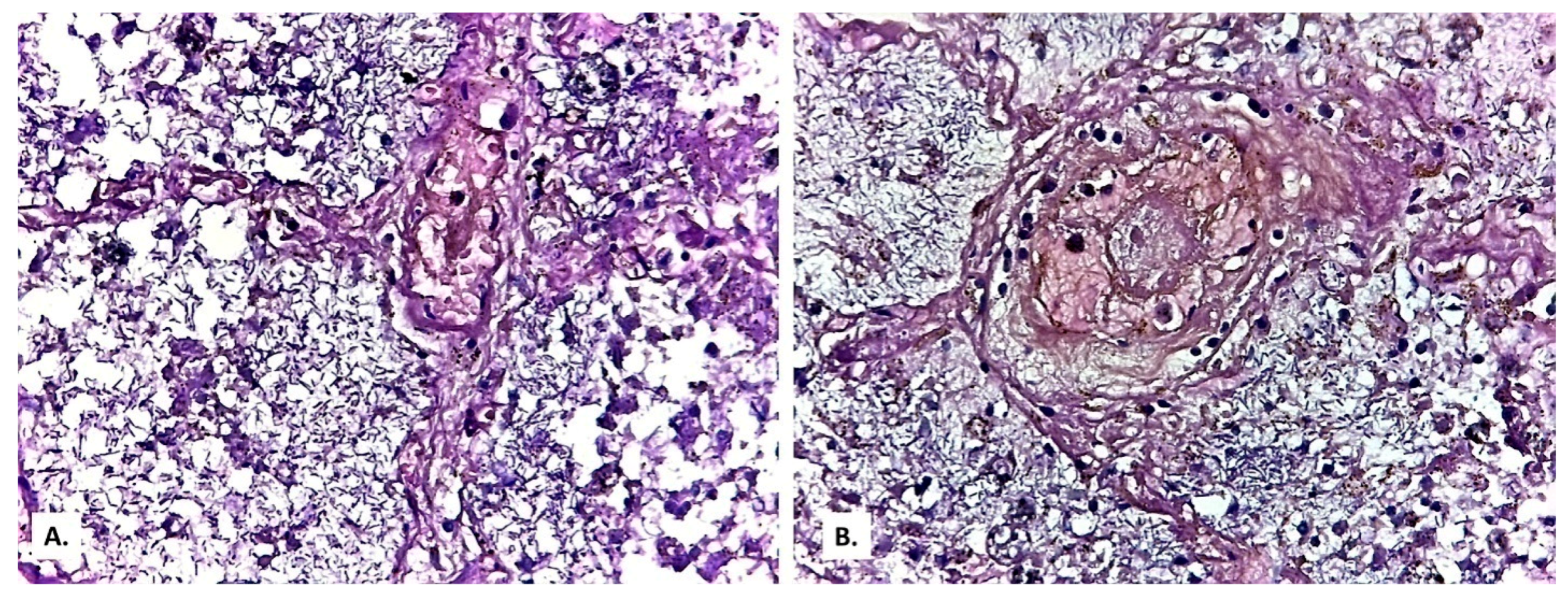 Medicina 57 00302 g011
