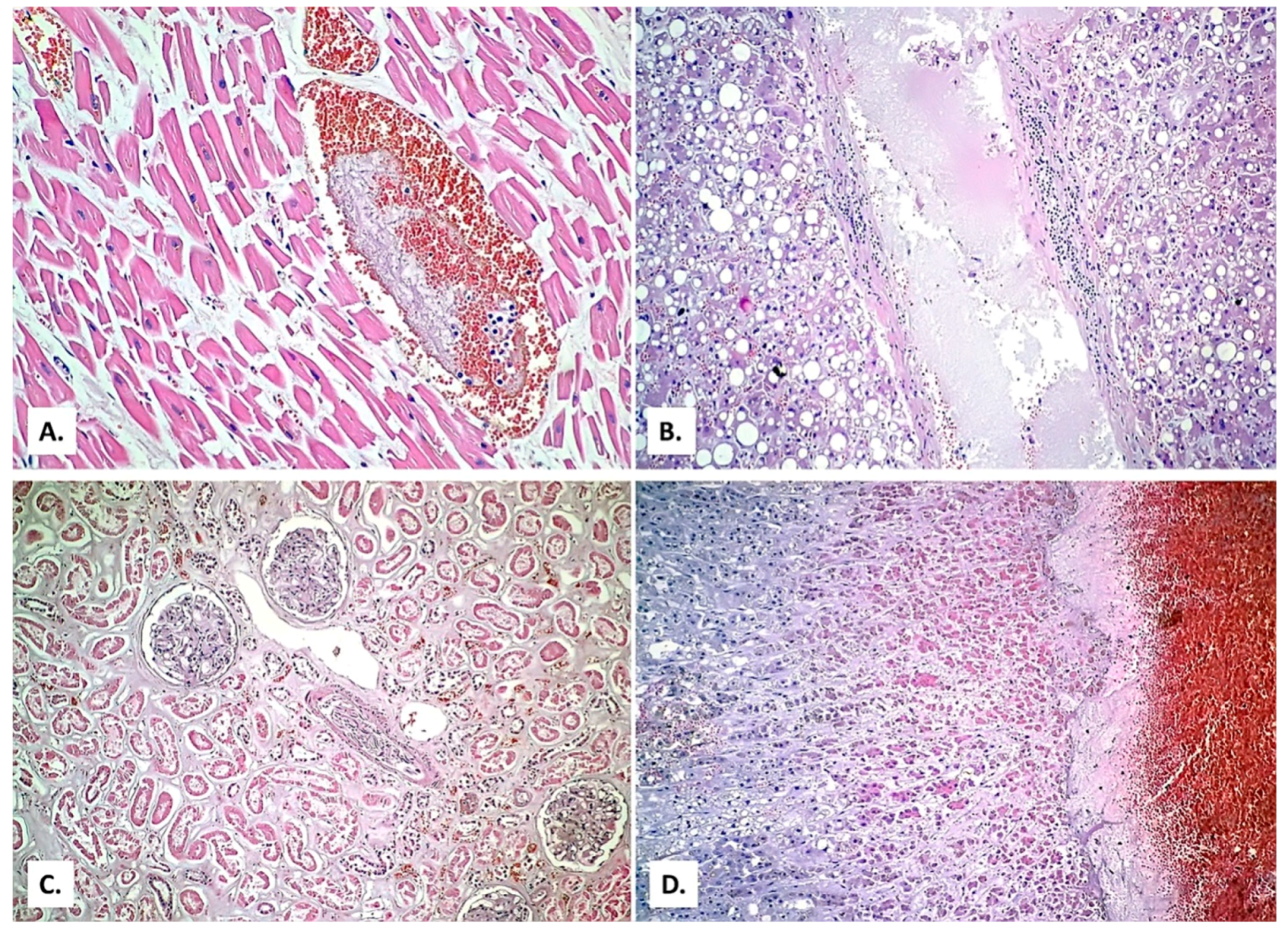 Medicina 57 00302 g013