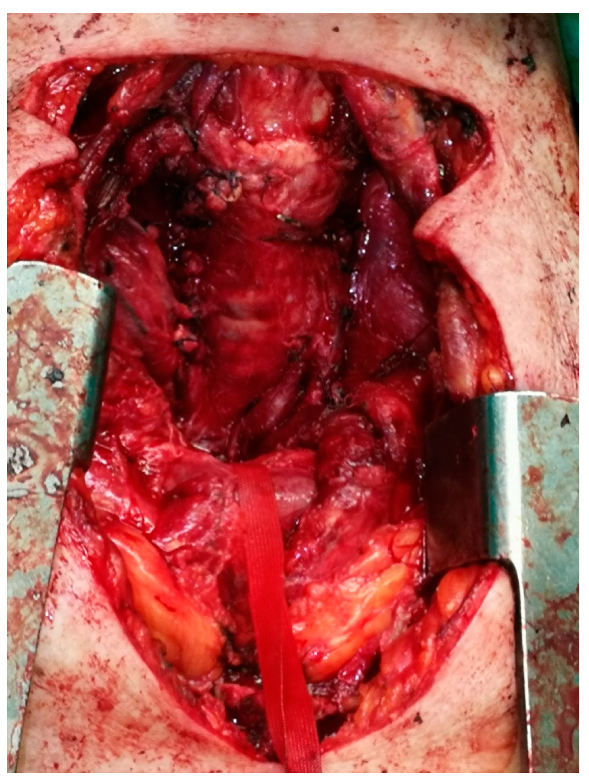 Medicina 57 00303 g005