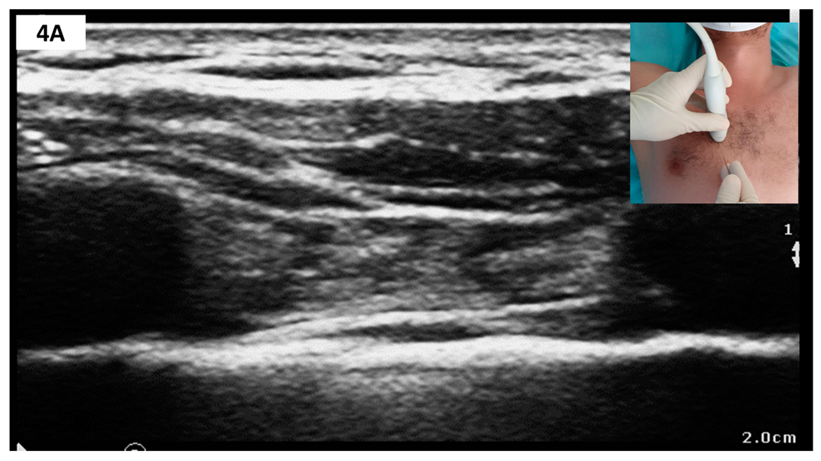 Medicina 57 00312 g004a