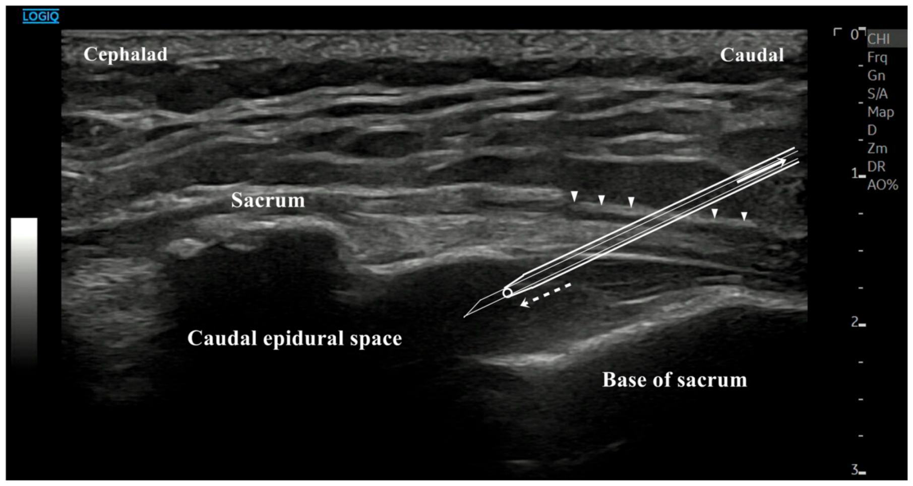 Medicina 57 00318 g001 Medicina 57 00318 g001