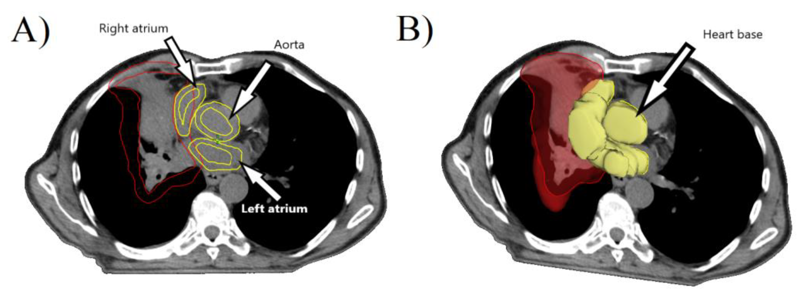 Medicina 57 00320 g001 Medicina 57 00320 g001