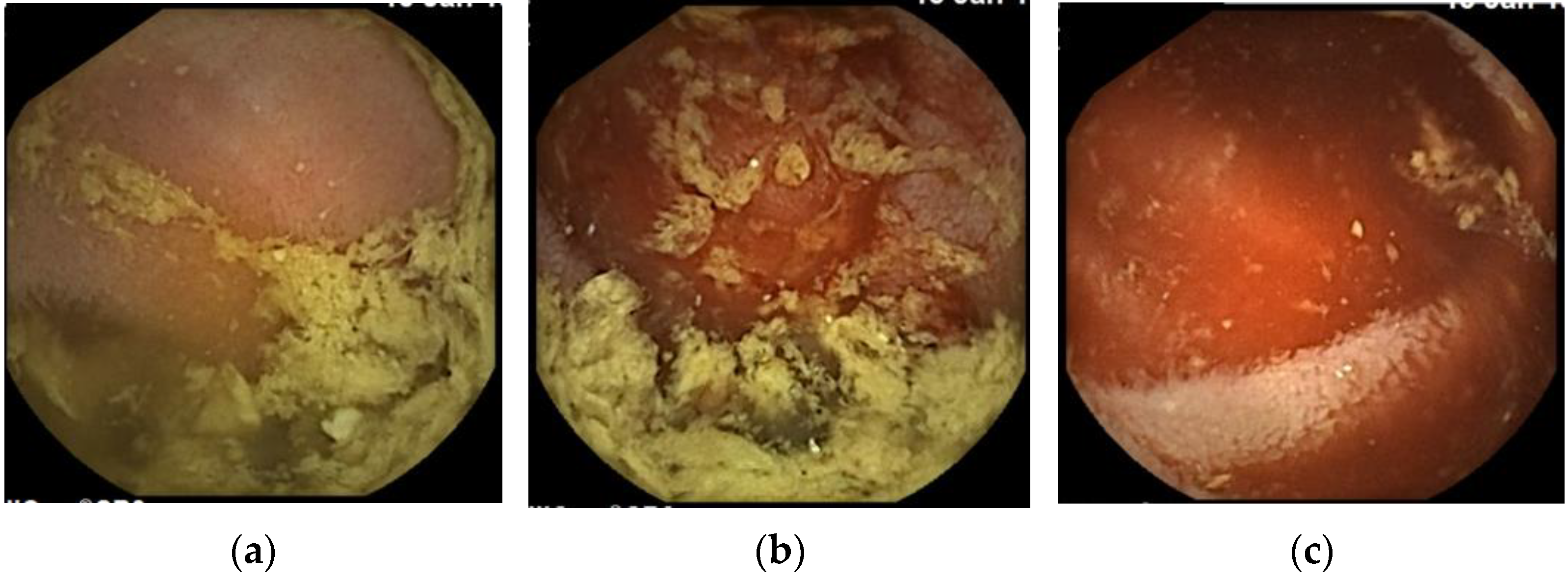 Medicina 57 00321 g003