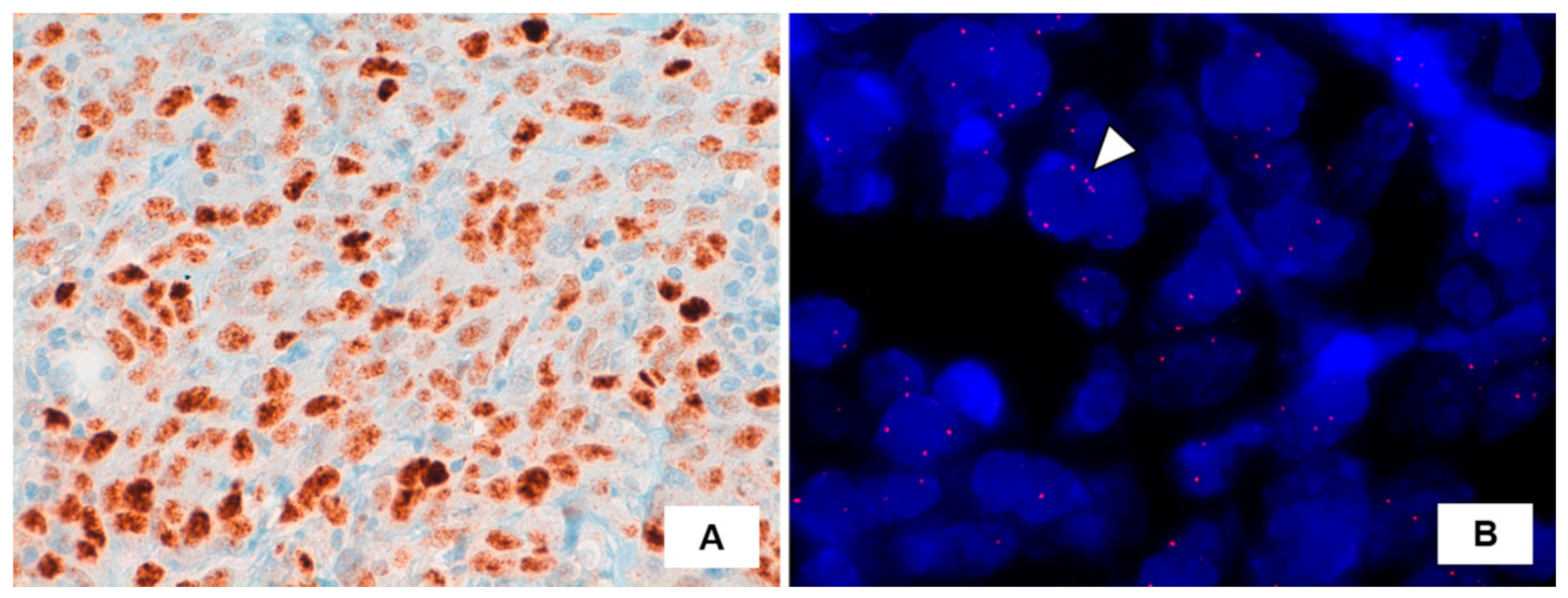 Medicina 57 00329 g002 Medicina 57 00329 g002