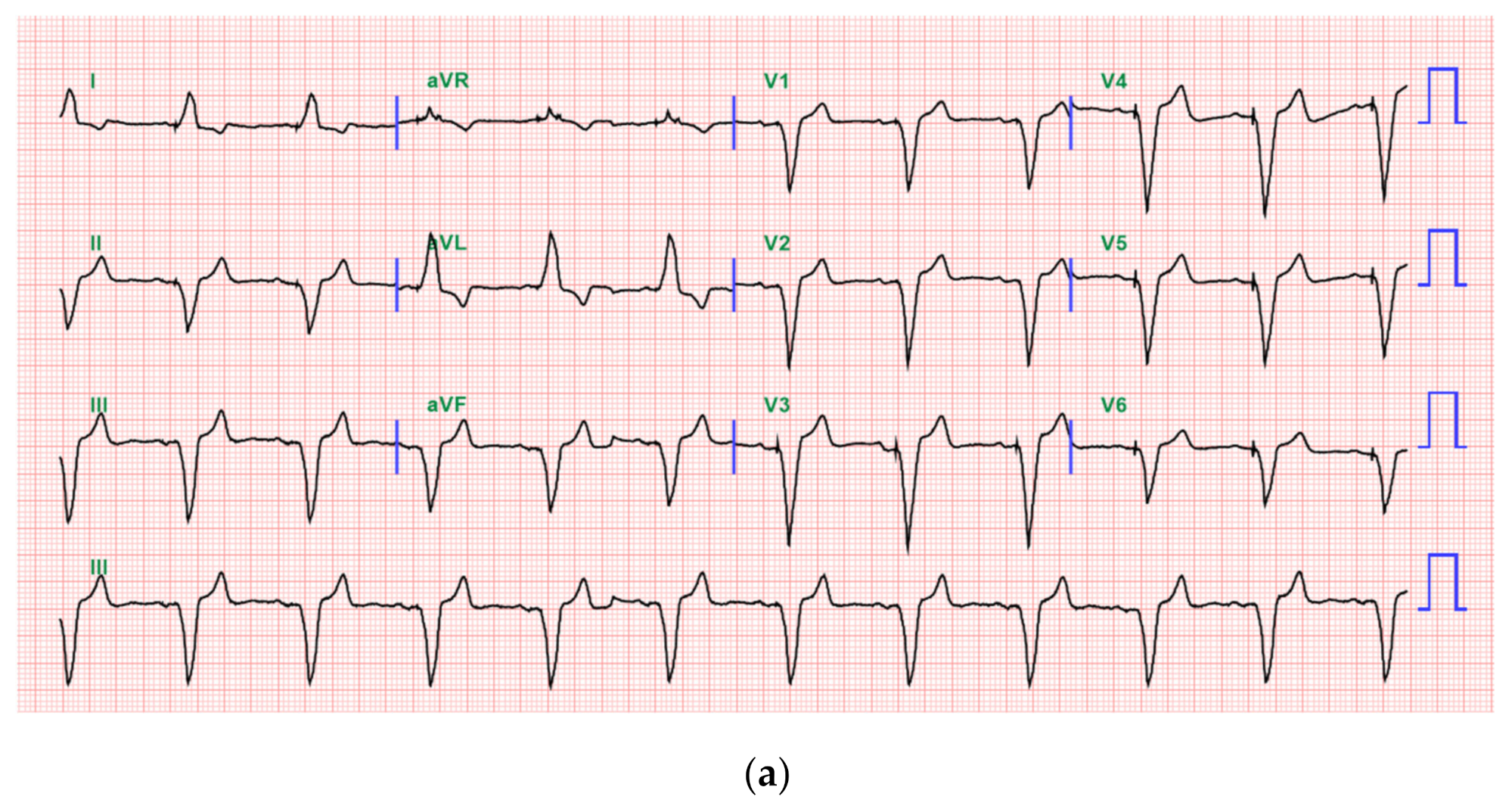 Medicina 57 00337 g002a