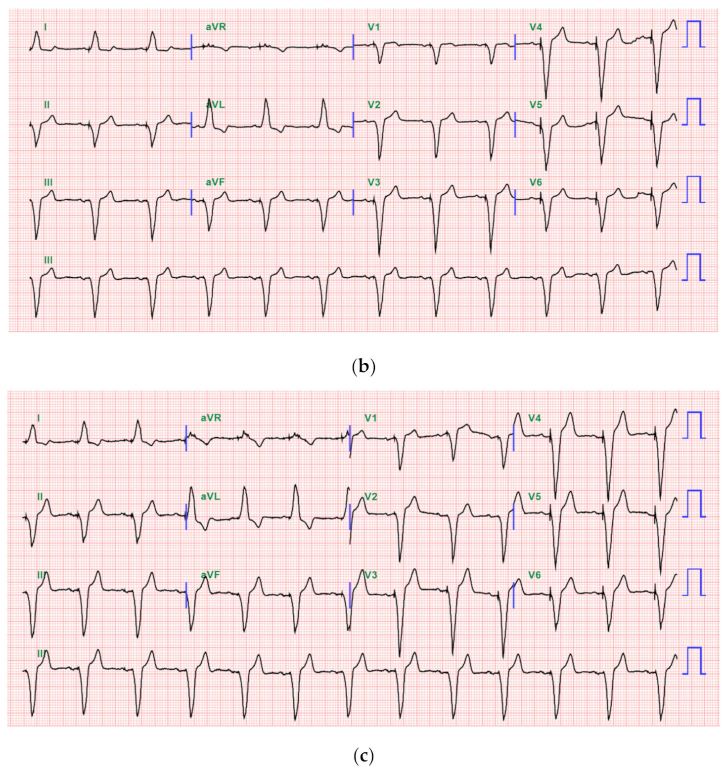 Medicina 57 00337 g002b